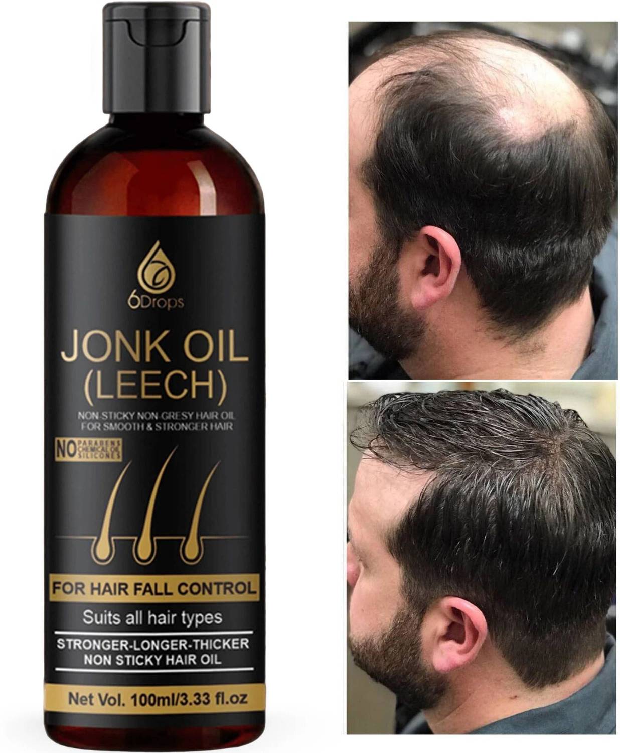 6Drops Leech Oil (Jonk Oil) For Hair Growth Oil Men & Women -anti-dandruff Hair Oil