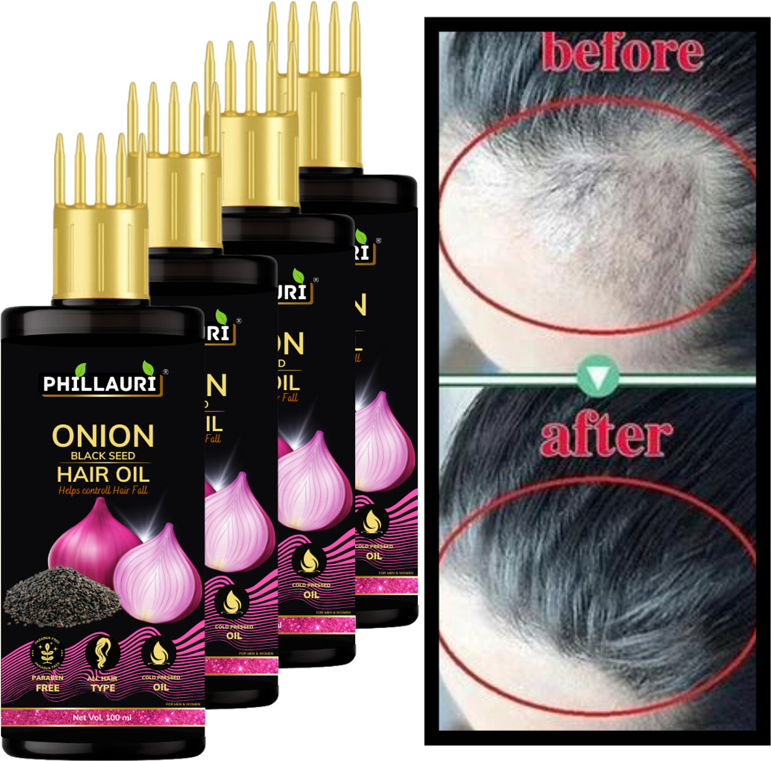 Image of Phillauri BlackSeed Onion Hair Oil All Hair Problem Herbal Growth Hair Loss Control Hair Oil