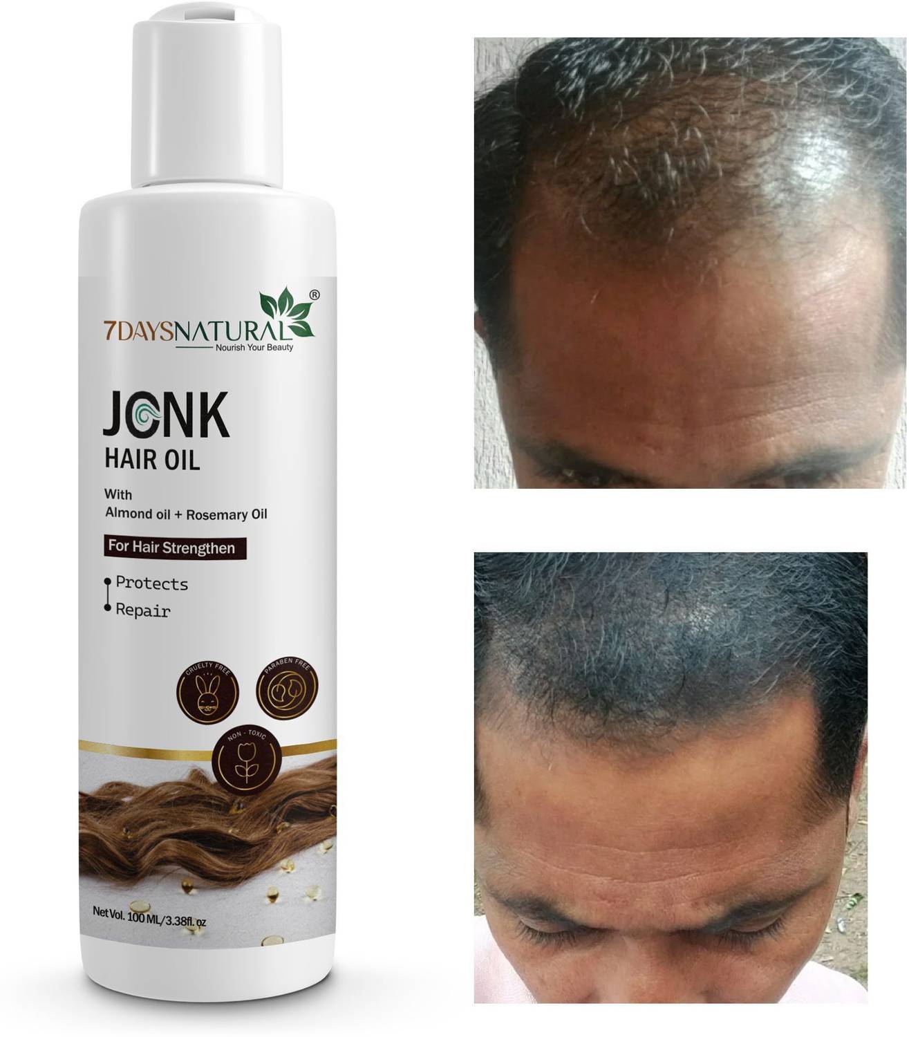 7 Days Ayurvedic Jonk Leech Oil for Hair Fall Control & Start New Hair Growth Hair Oil