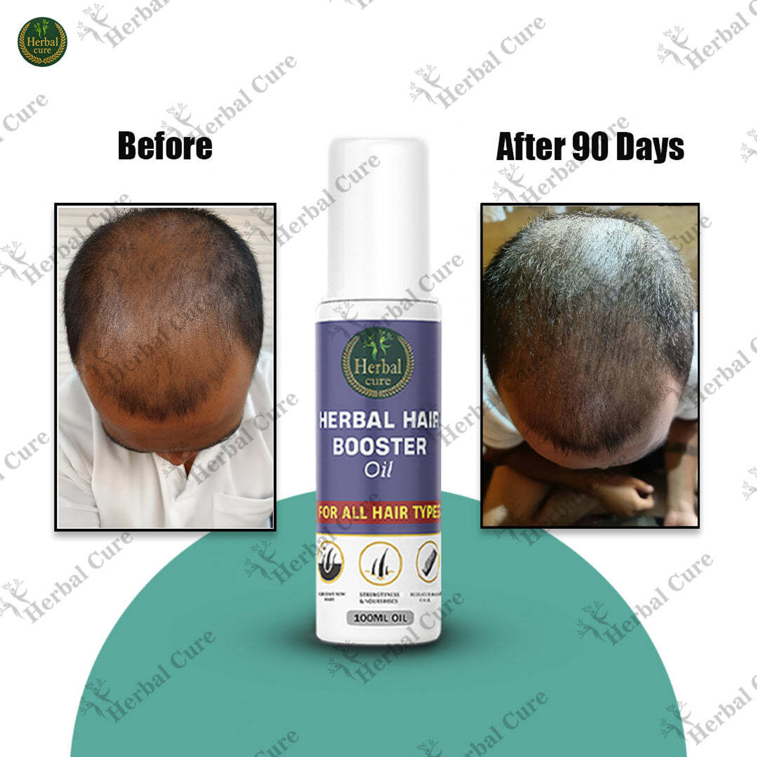 Image of Herbal Cure Herbal Hair Booster Oil for Shiny & Healthy Hair for Men and Women Hair Oil