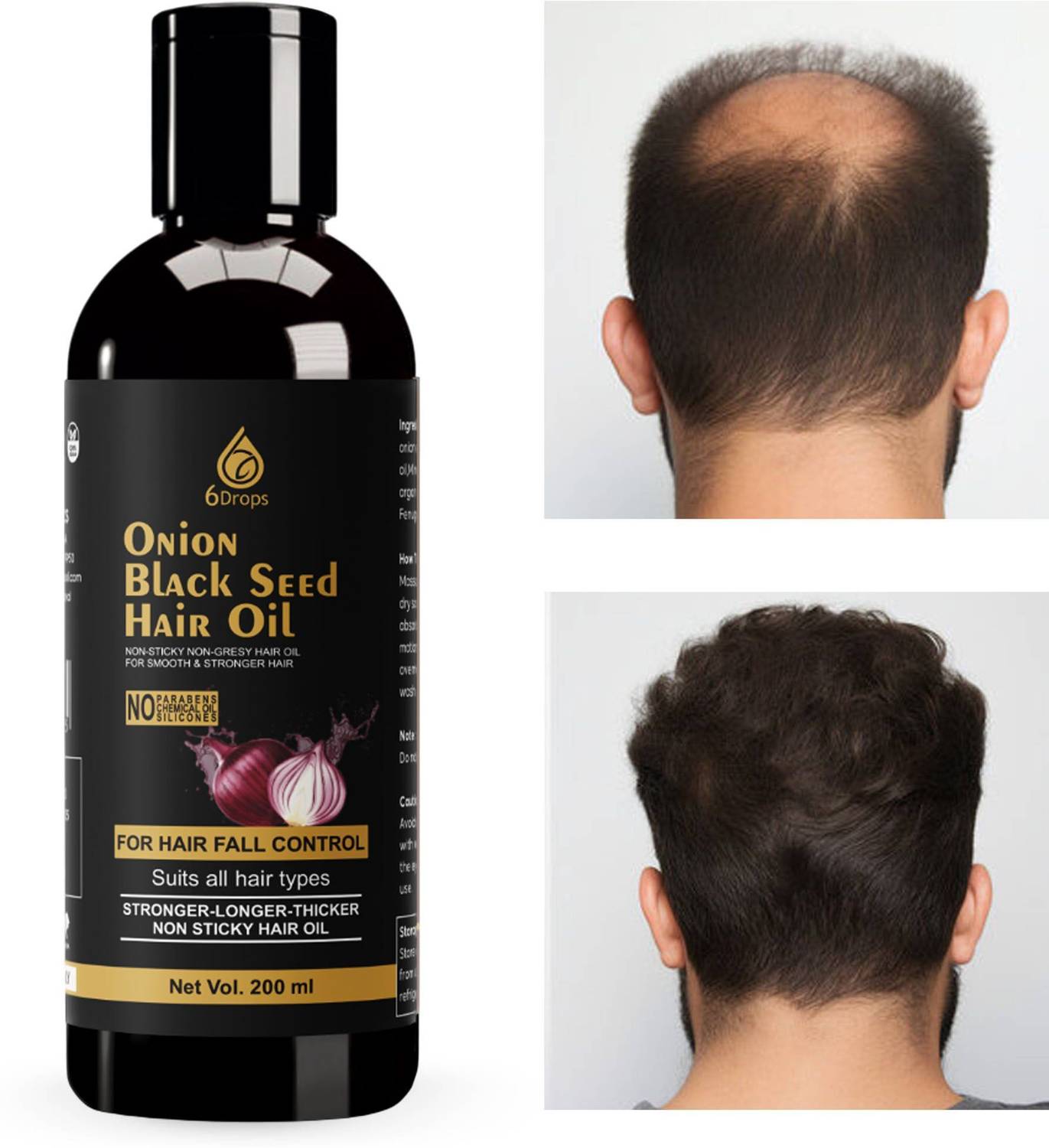 6Drops Onion Hair Oil – 200ml with Black Seed for Smooth Hair Hair Oil