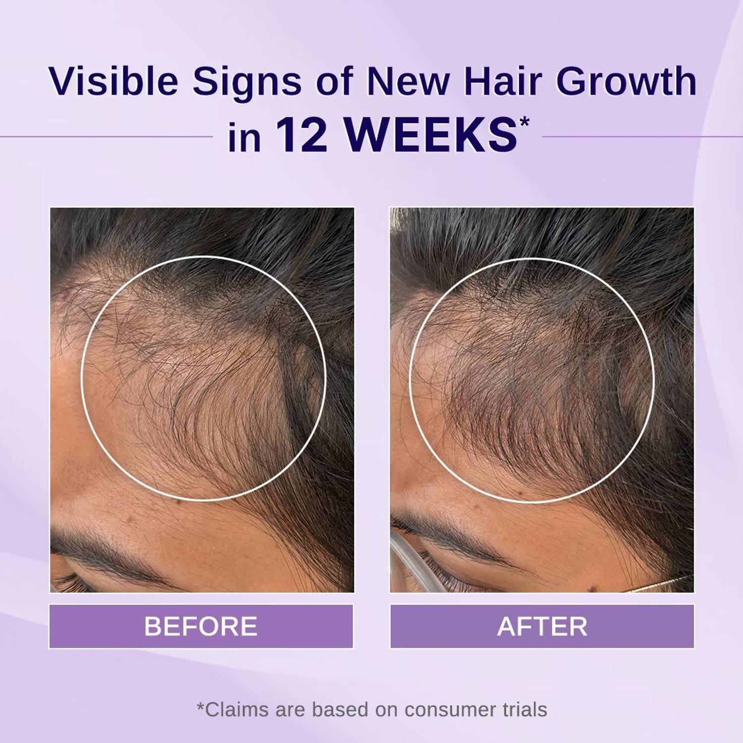 BARE Rosemary & Hibiscus Hair Growth Oil 100ml - Image 2