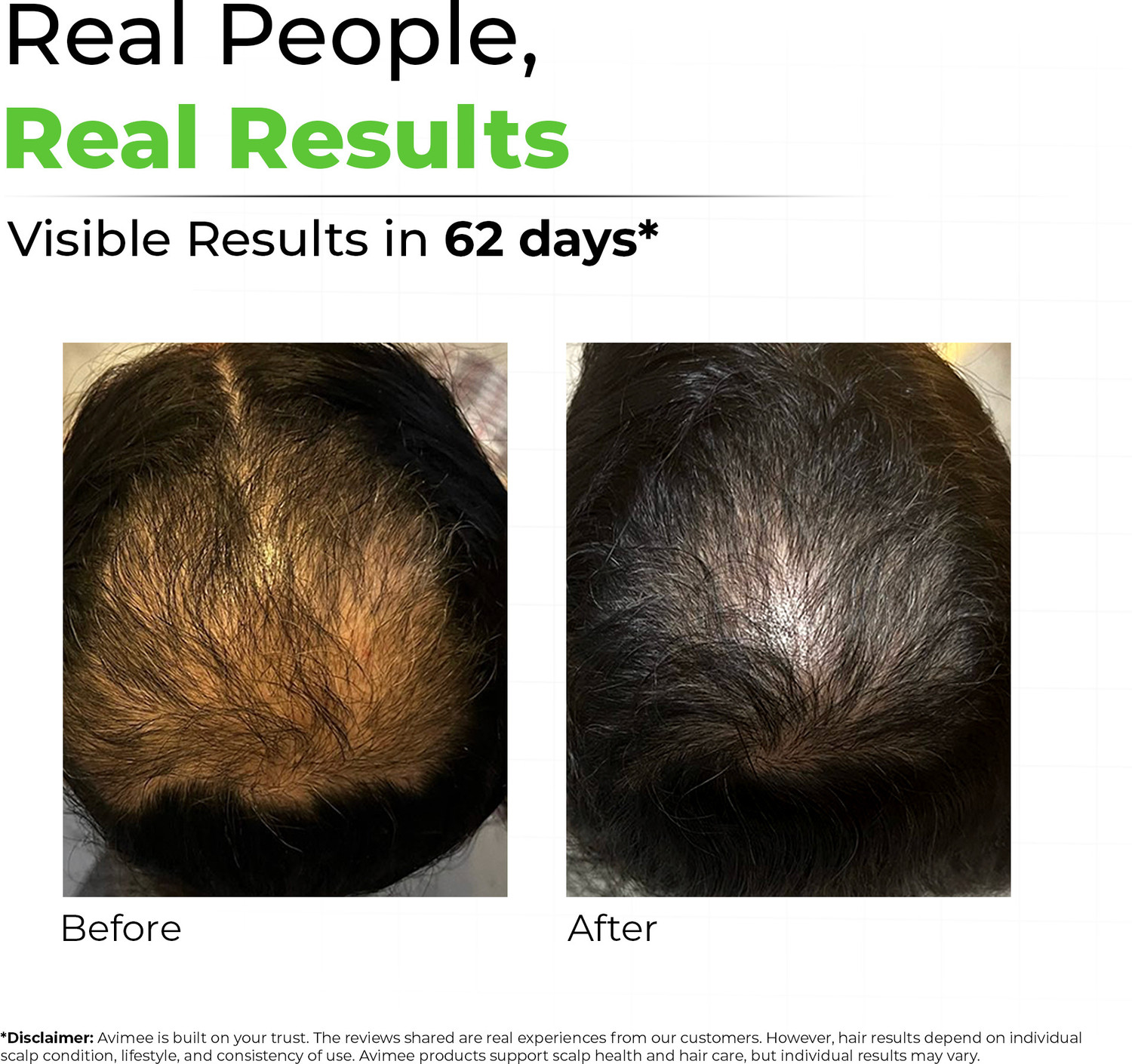 Image of Avimee Herbal Keshpallav Hair Oil with Rosemary | Hairfall Control and Growth Hair Oil (50 ml) Hair Oil