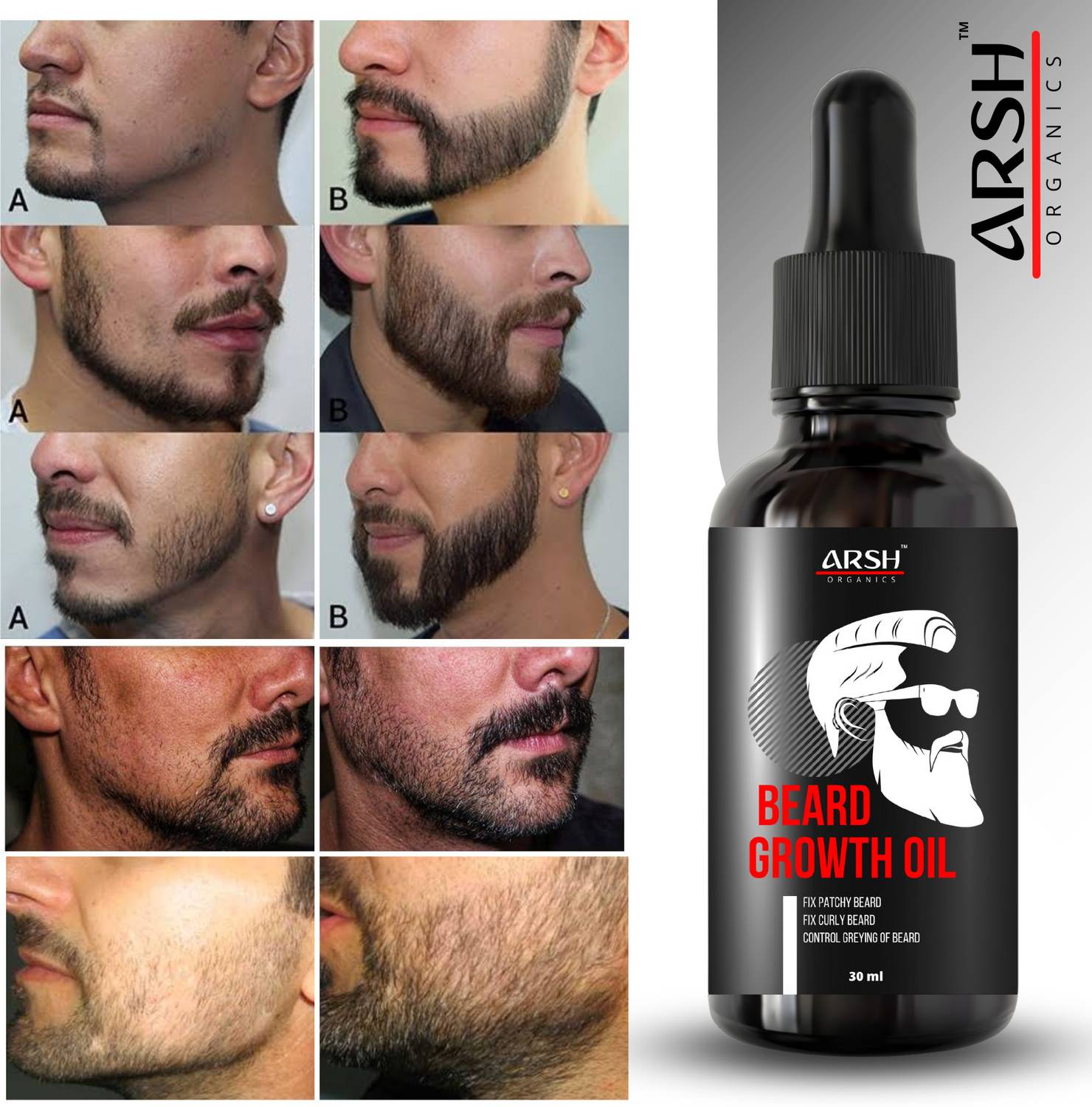 Arsh Organics "Prime Growth: Fuel Your Beard's Potential with our