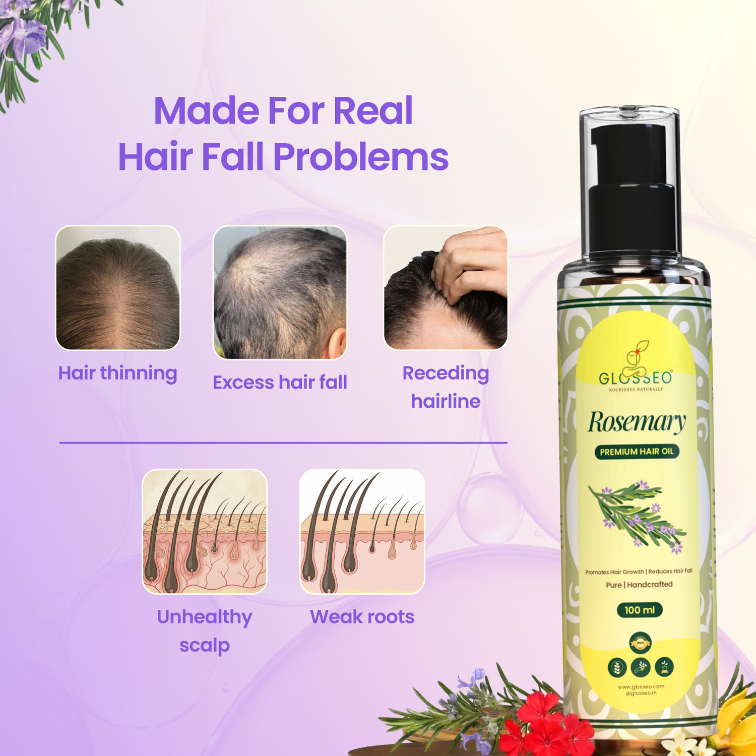 Image of Glosseo Rosemary Hair Oil 4 Qty. | Double Growth & Stop Hairfall in 2 week | Scalp Food Hair Oil