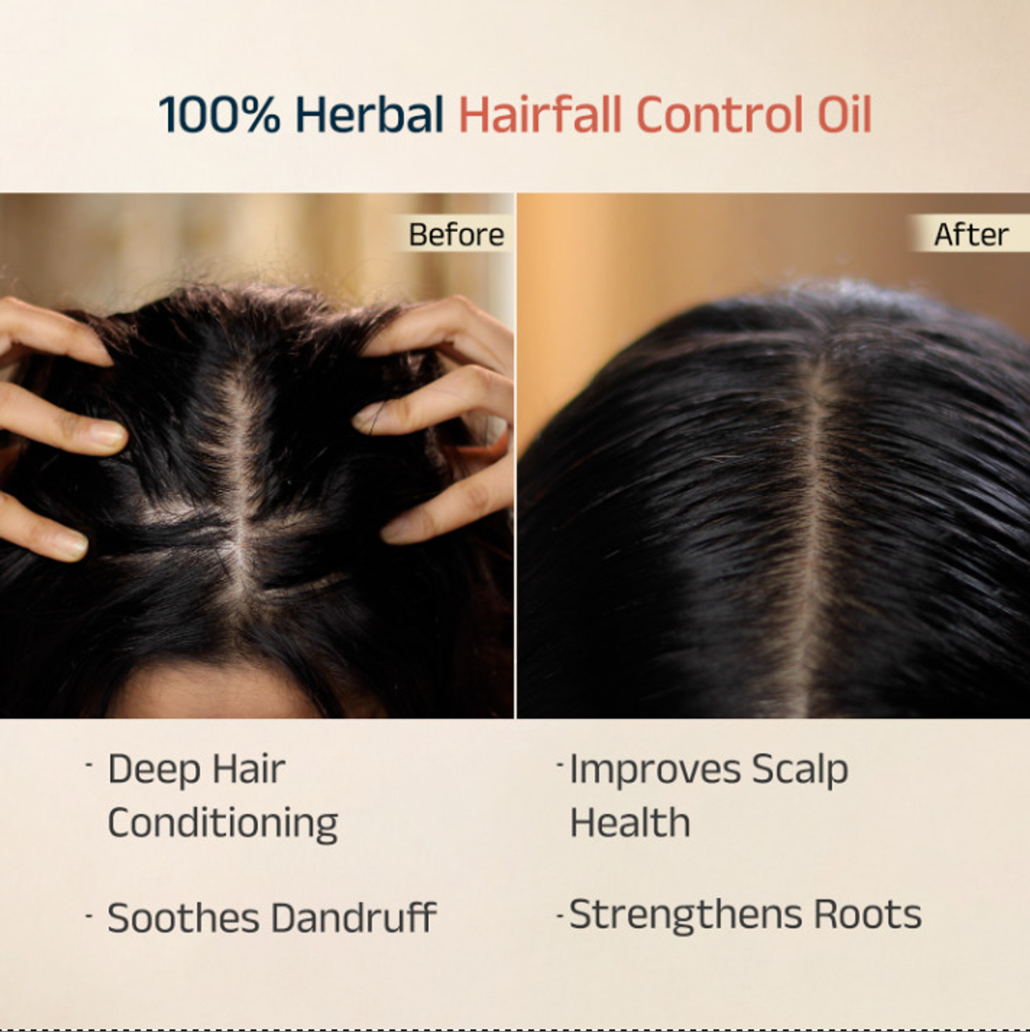 Image of Vedix Keshamrut Herb Infused Ayurvedic Anti-Hairfall Oil With Bhringraj & Rosemary Hair Oil