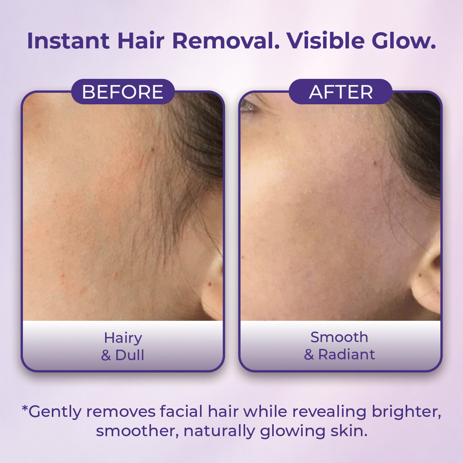 Image of Sanfe Ubtan Facial Hair Removal Cream No Cuts, No Pain | For Women & Men Cream