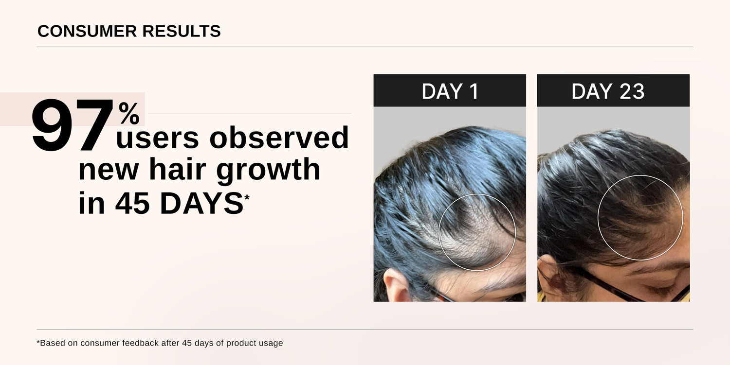 Image of BARE ANATOMY Advanced Hair Growth Serum - Redensyl, Rosemary, Anagain, Biotin | Women & Men