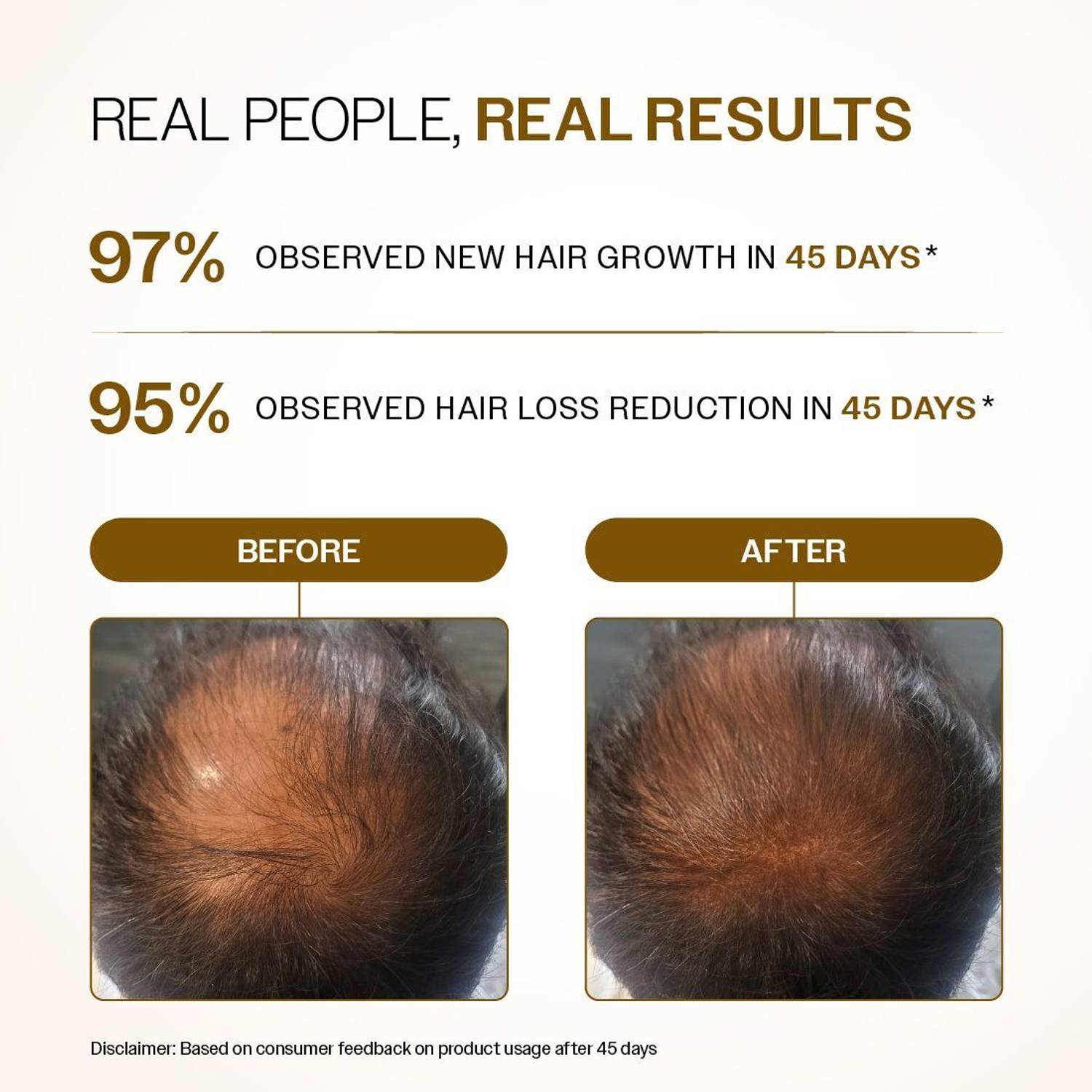 BARE ANATOMY Advanced Hair Growth Serum Roll-On 25ml - Image 4