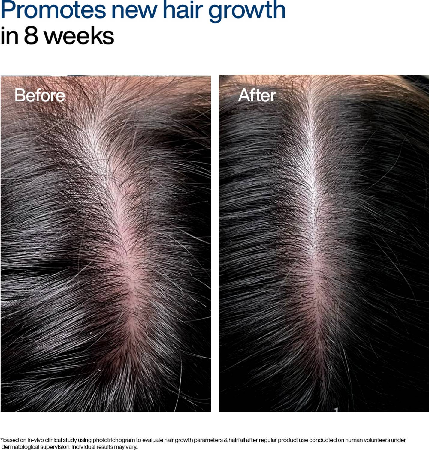 WishCare Hair Growth Serum Roll On With Redensyl - Image 5