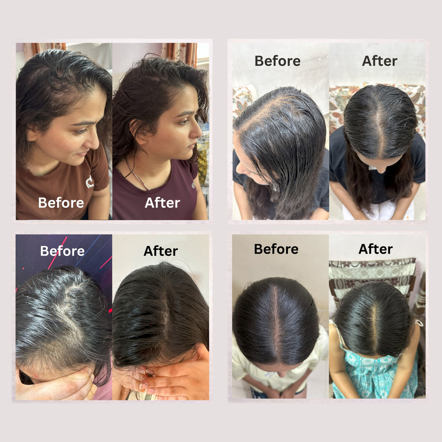 Image of SAYY Scalp Revival Hair Serum |Lightweight Non-Greasy | Daily Scalp Care