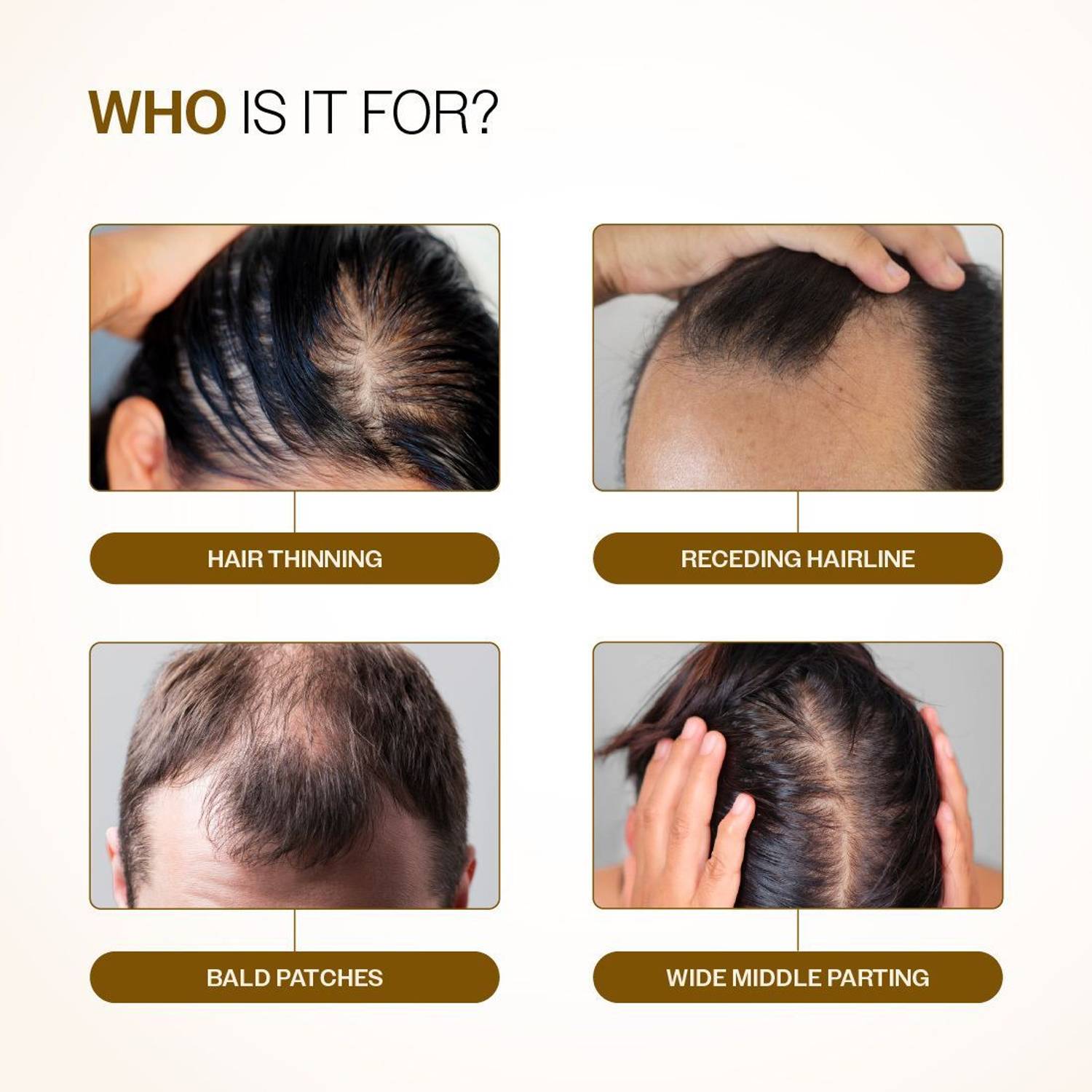BARE ANATOMY Advanced Hair Growth Serum Roll-On 25ml - Image 3