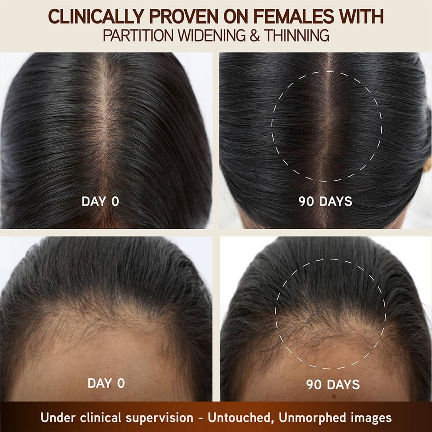 Indulekha Bringha Hair Growth Treatment Scalp Serum, 30ml - Image 4
