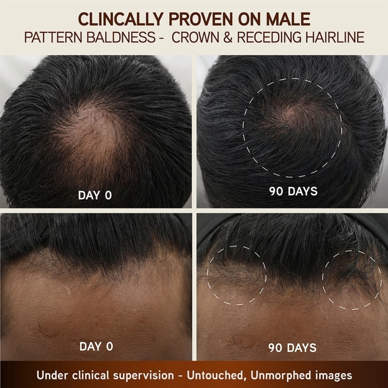 Image of indulekha Hair Growth Treatment Scalp Serum with Rosemary and Amla for Hair Growth