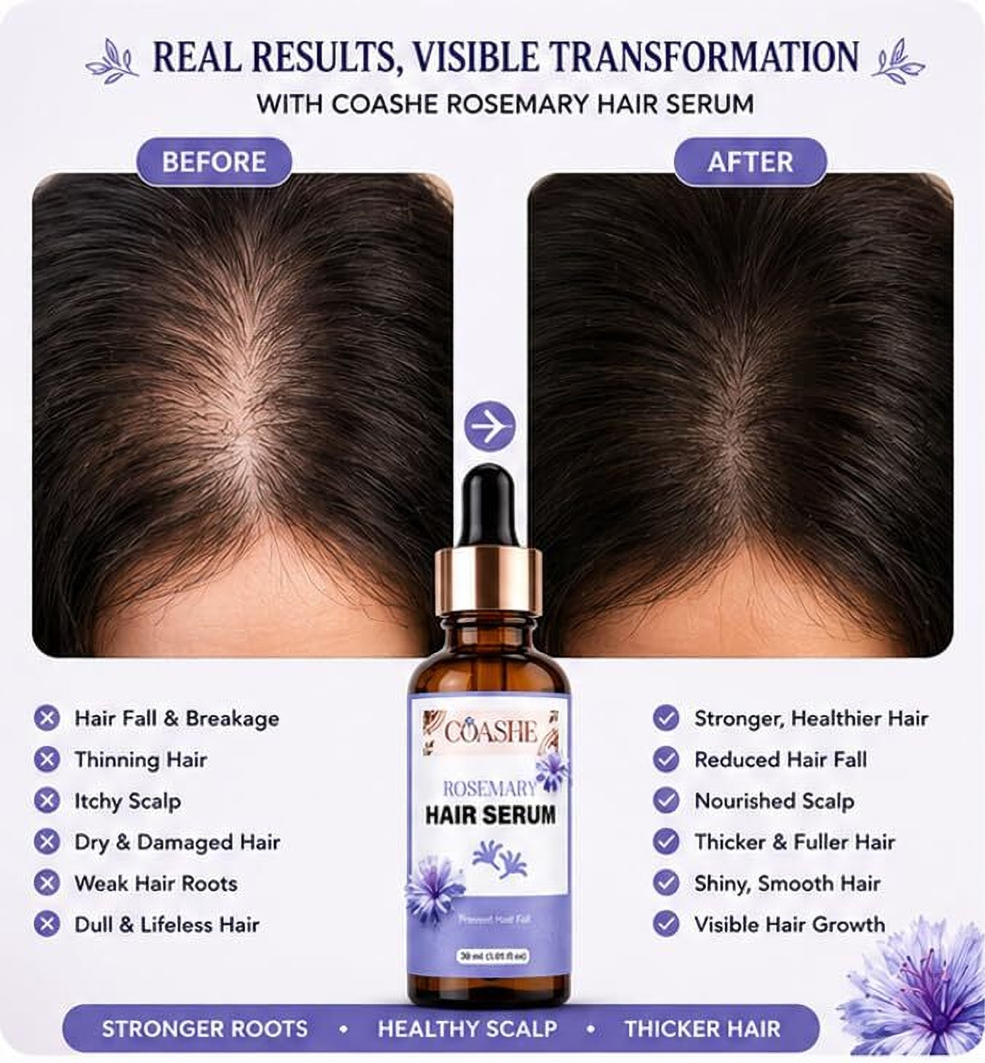 Image of coashe Rosemary Hair Serum for Men & Women | Lightweight Hair & Scalp Serum | 30 ml