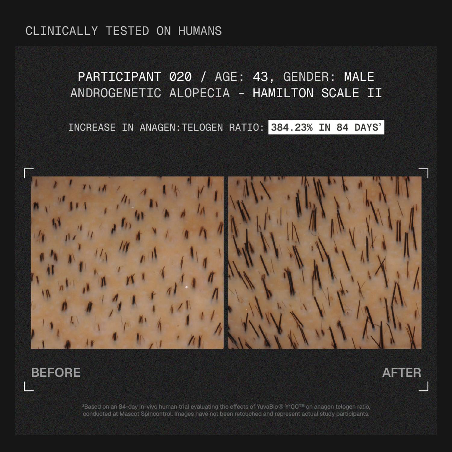 ARATA MitoActive | Reduces Hair Fall & Boost Hair Growth | With Y100 | For Men & Women - Image 3