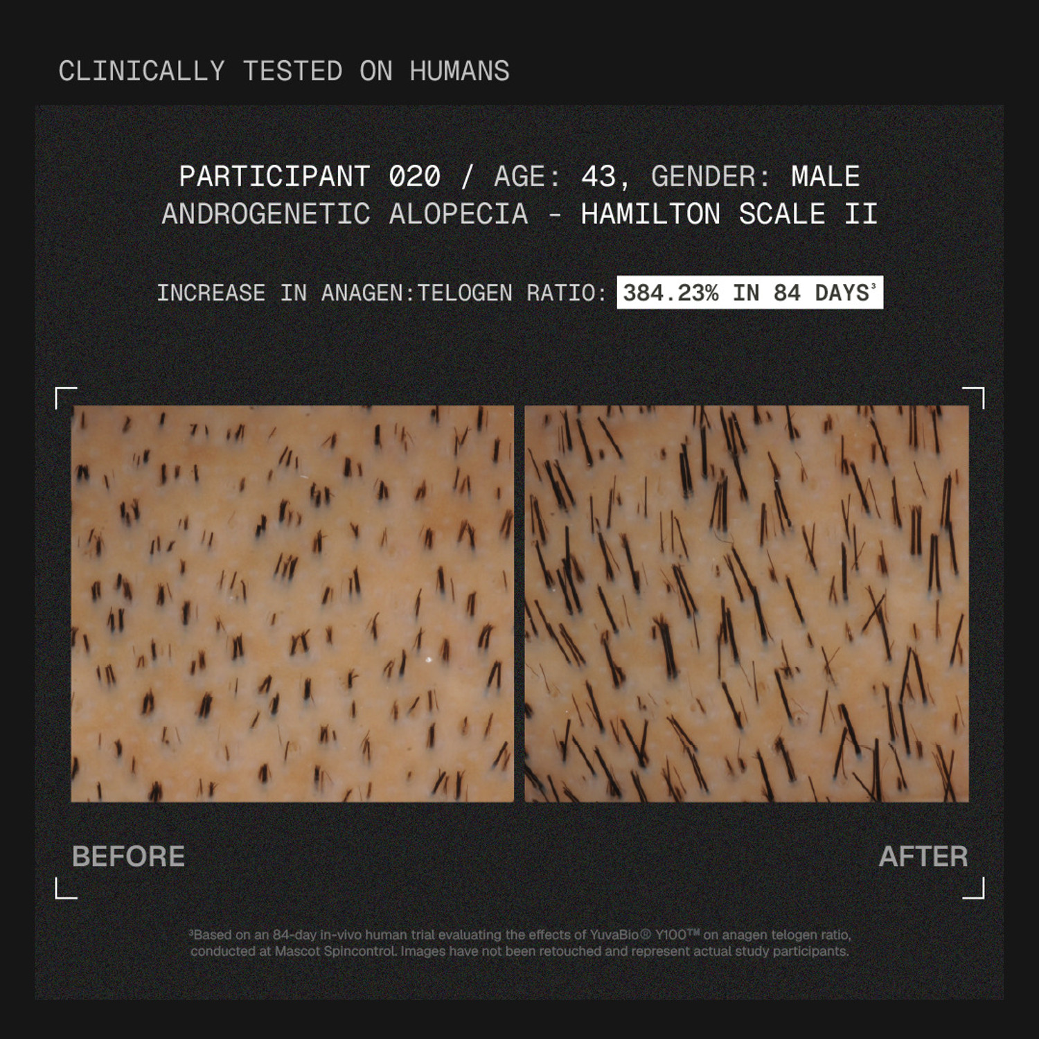 Image of ARATA MitoActive | Reduces Hair Fall & Boost Hair Growth | With Y100 | For Men & Women
