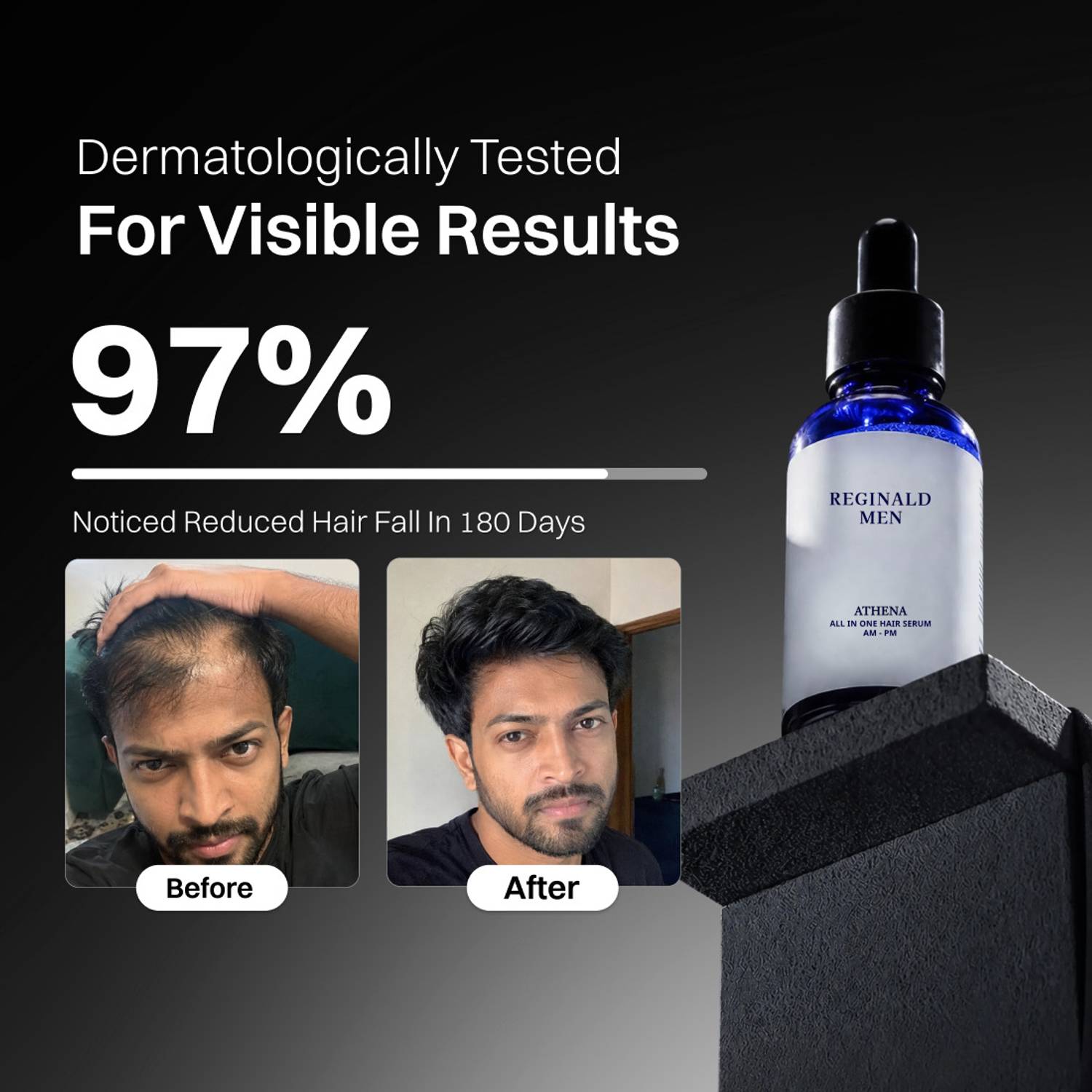 All in one Hair growth Serum|Hair Fall Control & Follicle Boost with 12 Actives - Image 5