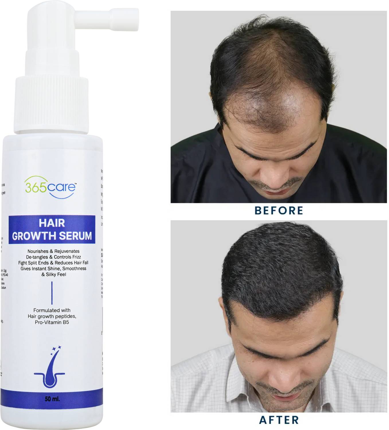 365Care Hair Growth Serum Nourishes & Rejuvenates, Reduces Hair Fall Men & Women