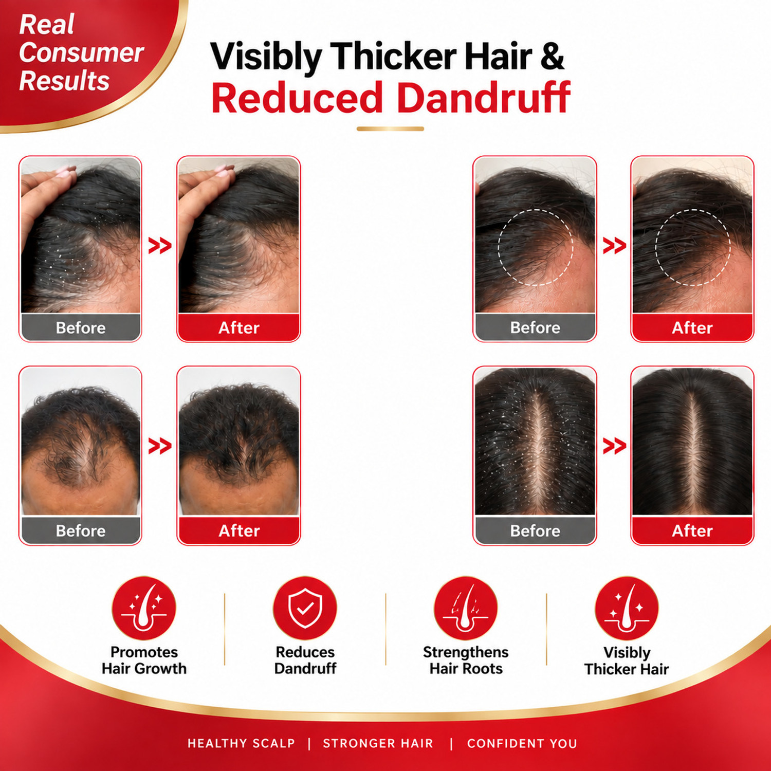 Image of Refollium Advanced Hair Growth Serum 3% Redensyl, 4% Anagain | Scalp & Regrowth (30 ml)