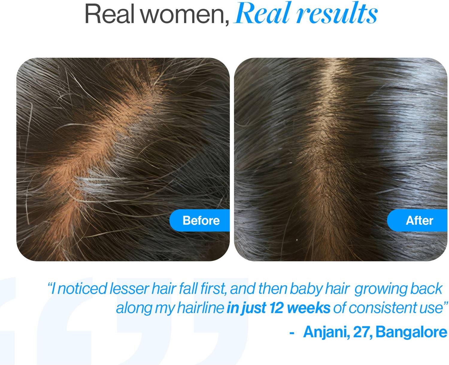 Be Bodywise 3% Redensyl & Rosemary Hair Growth Serum Roll On - Image 3