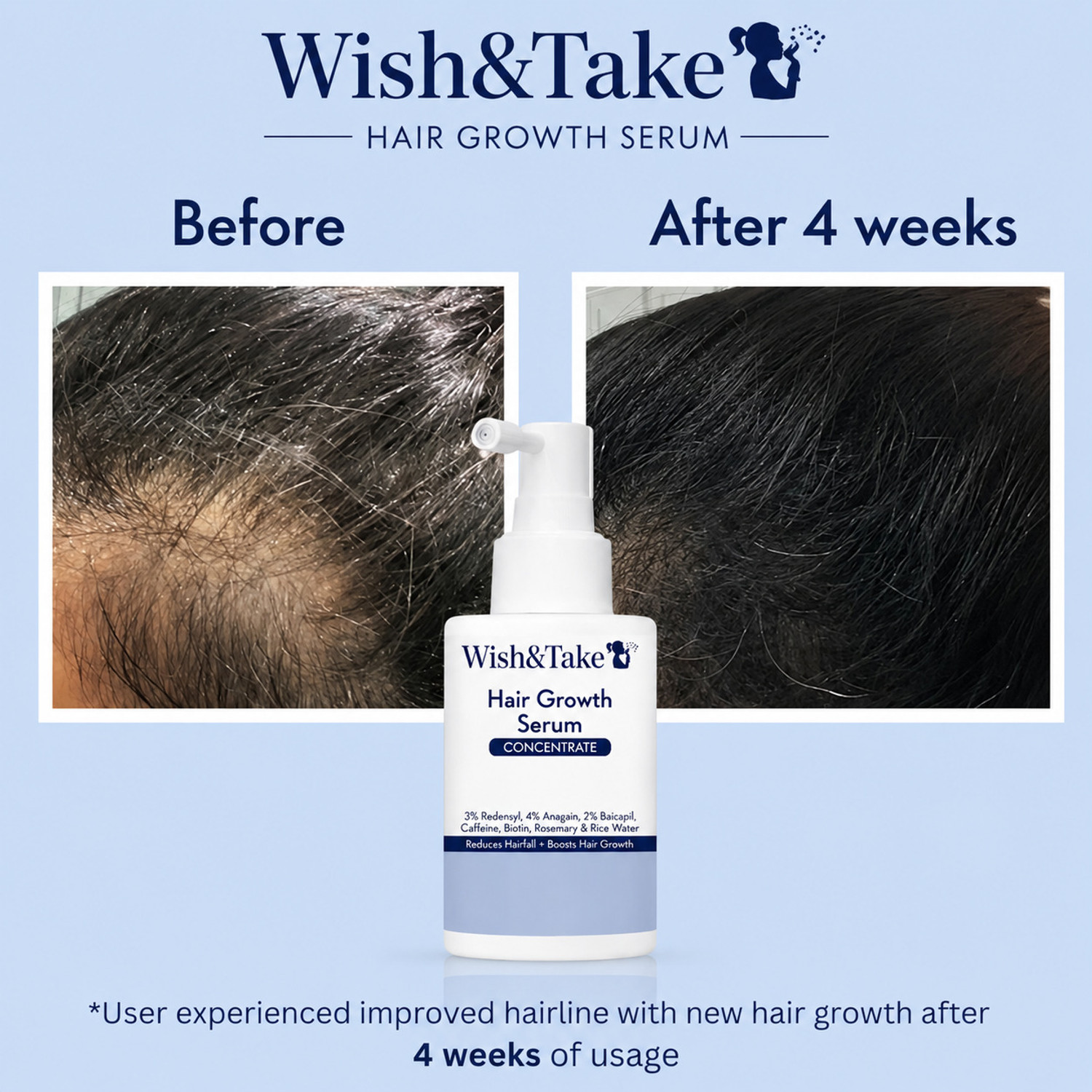 Image of WISH&TAKE Hair Growth Serum 3% Redensyl, 4% Anagain, 3% Baicapil | For Hairfall Control