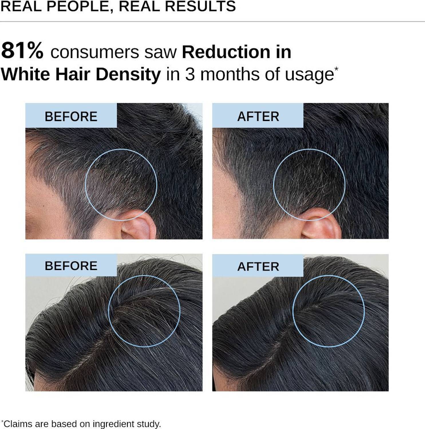 BARE Advanced Anti-Grey Hair Serum 50 ml - Image 3