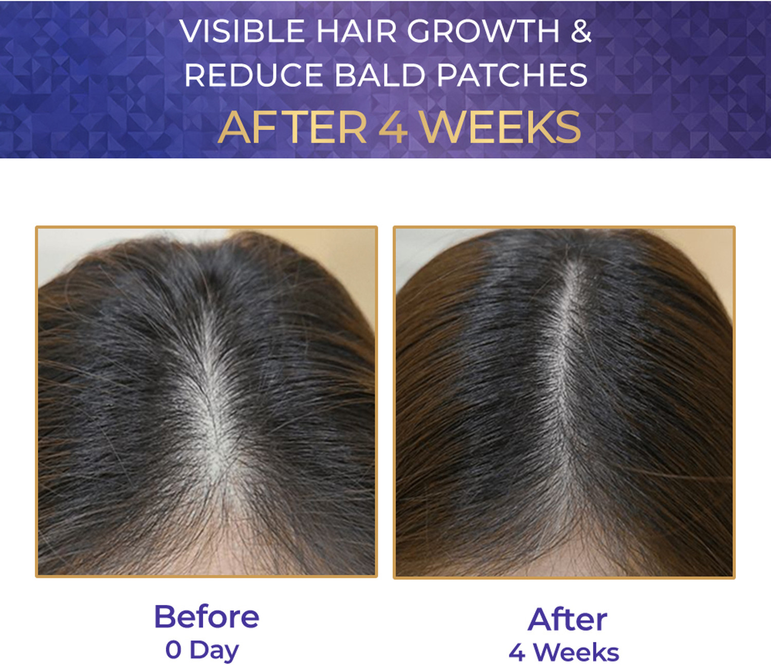 Image of Streax Hair Growth Serum - 30ml, 3% Redensyl, 3% Anagain, 3% Baicapil