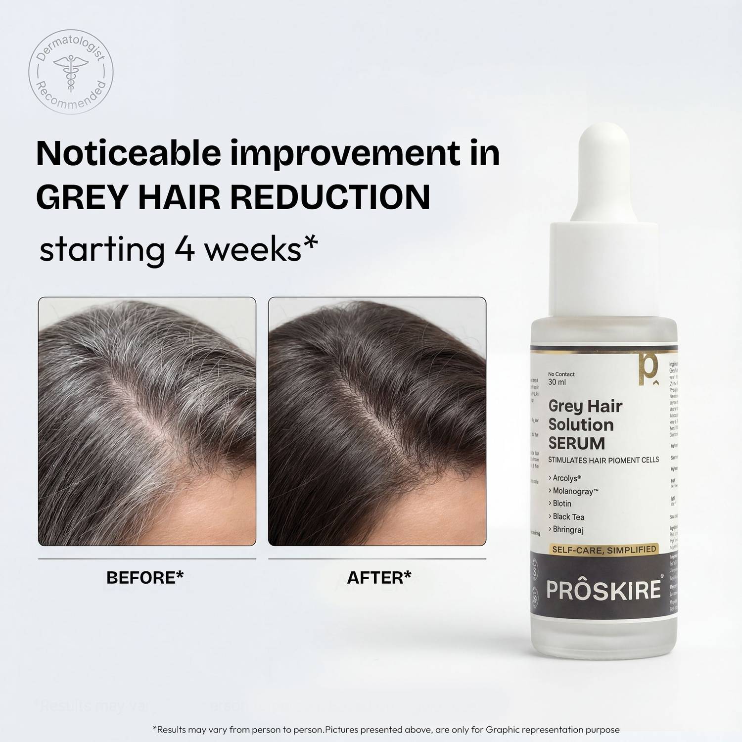 Proskire Grey Hair Solution Serum 30ml - Image 5