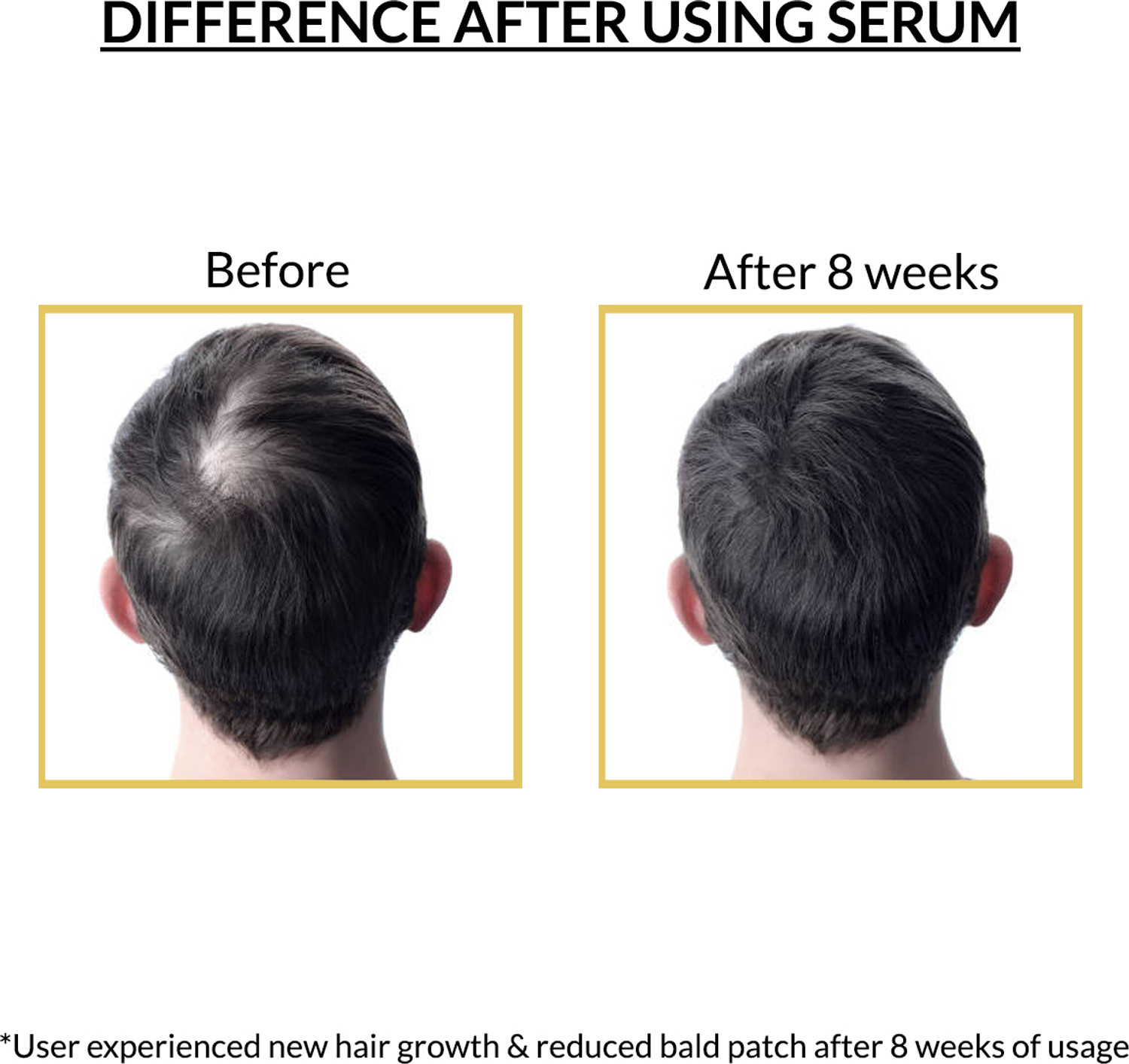 Image of Urban Barber Advanced Hair Growth Serum with 3% Redensyl, 4% Anagain & 2% Procapil - Unisex