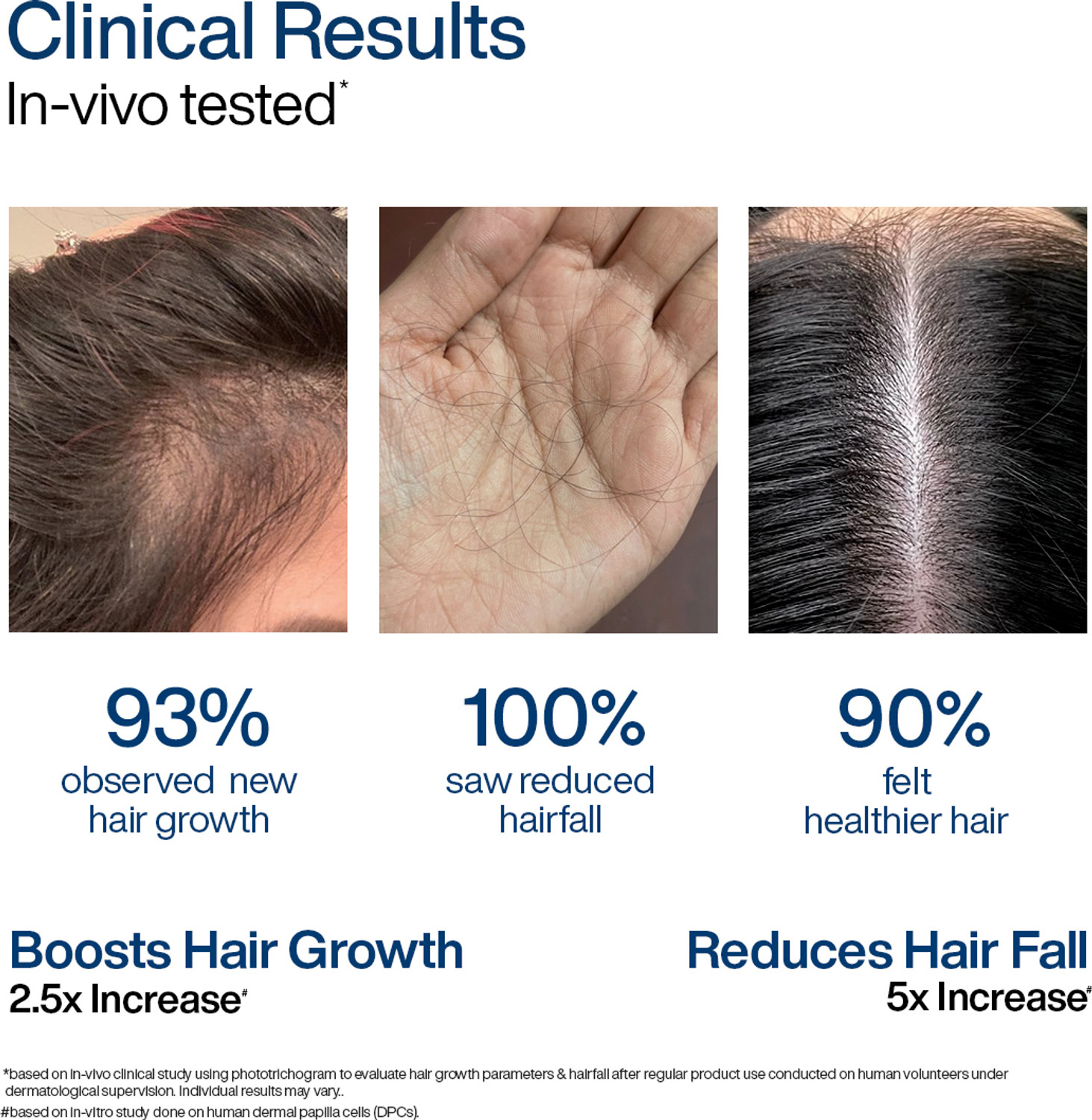 Image of WishCare Hair Growth Serum | In-Vivo Tested | For Hairfall Control | Redensyl & Anagain