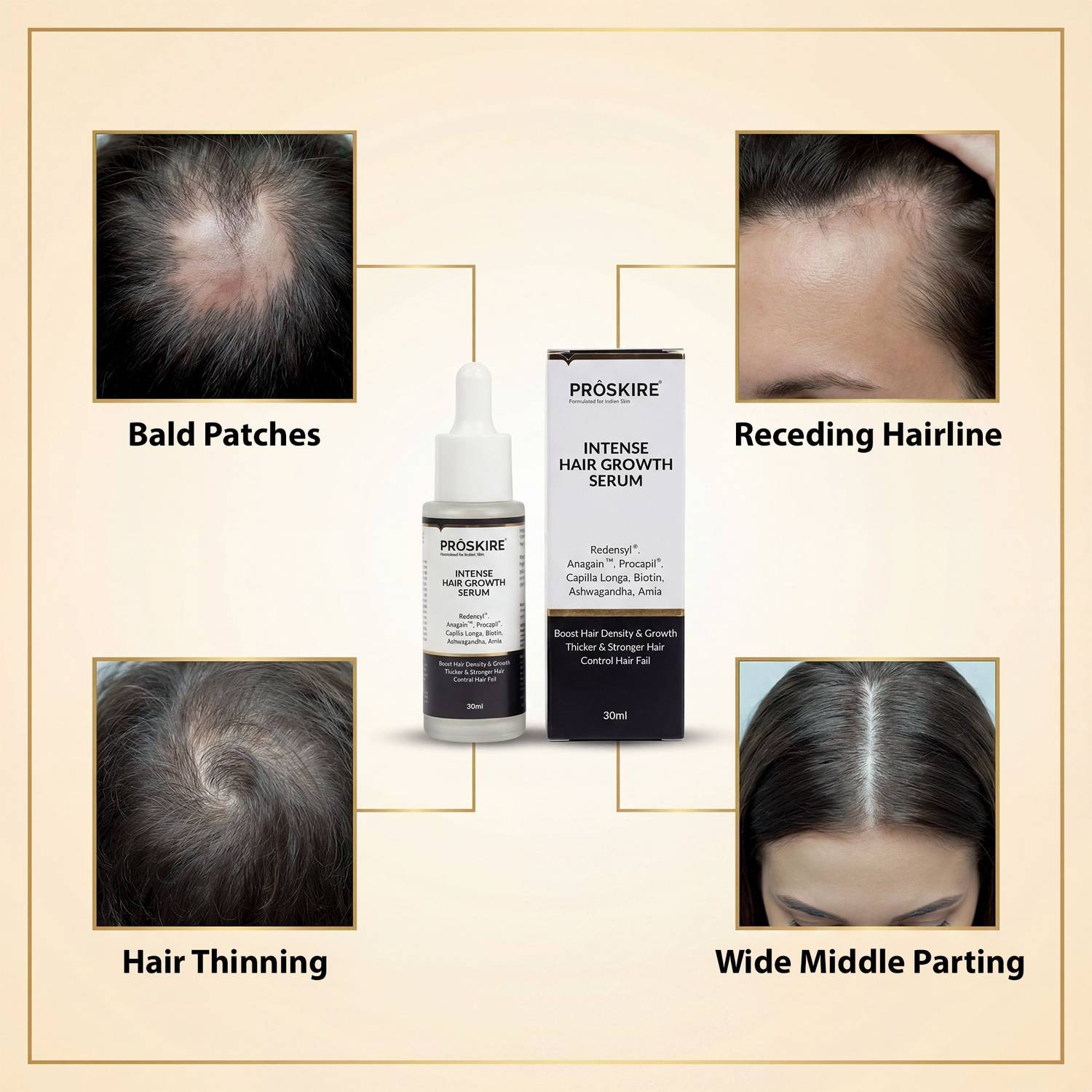 Proskire Intense Hair Growth Serum 30ml - Image 5