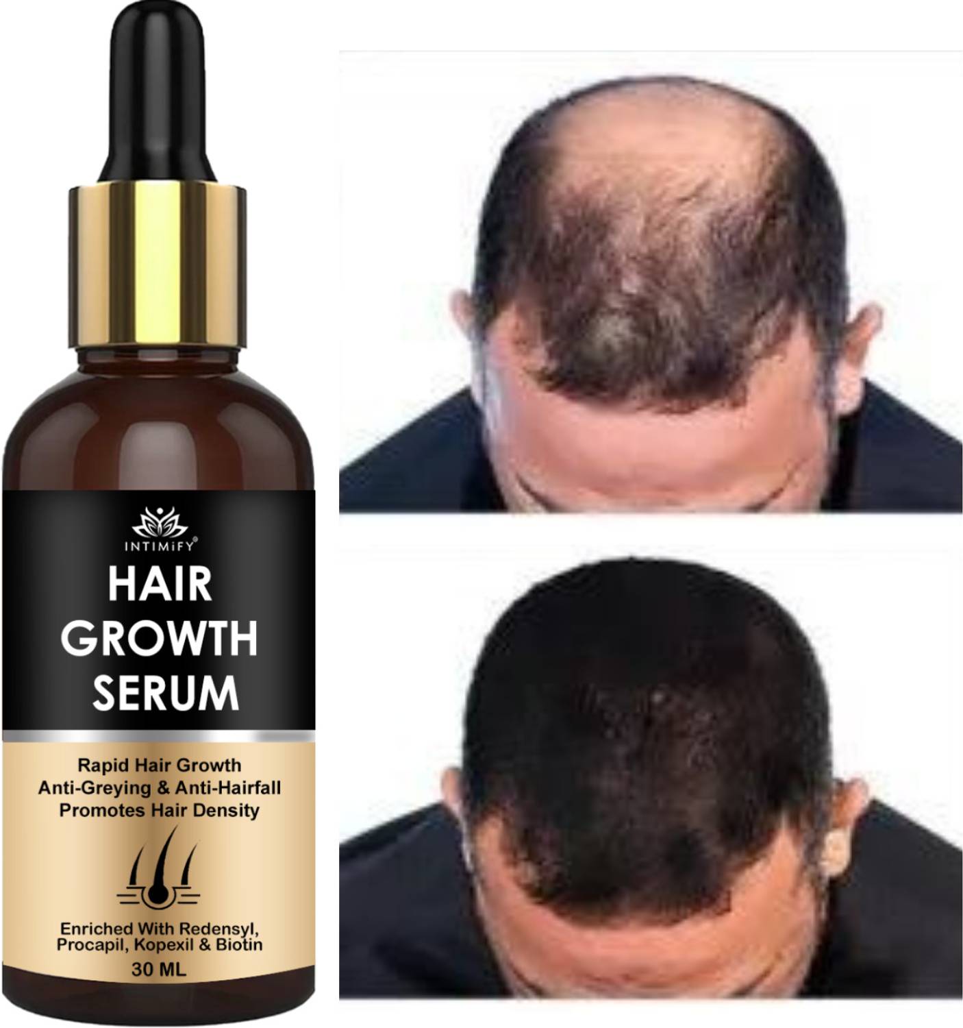Intimify Hair Growth Serum - Image 1