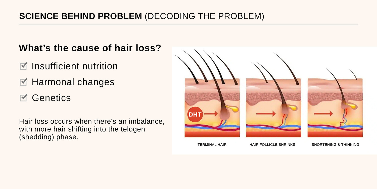 Image of BARE ANATOMY Advanced Hair Growth Serum - Redensyl, Rosemary, Anagain, Biotin | Women & Men