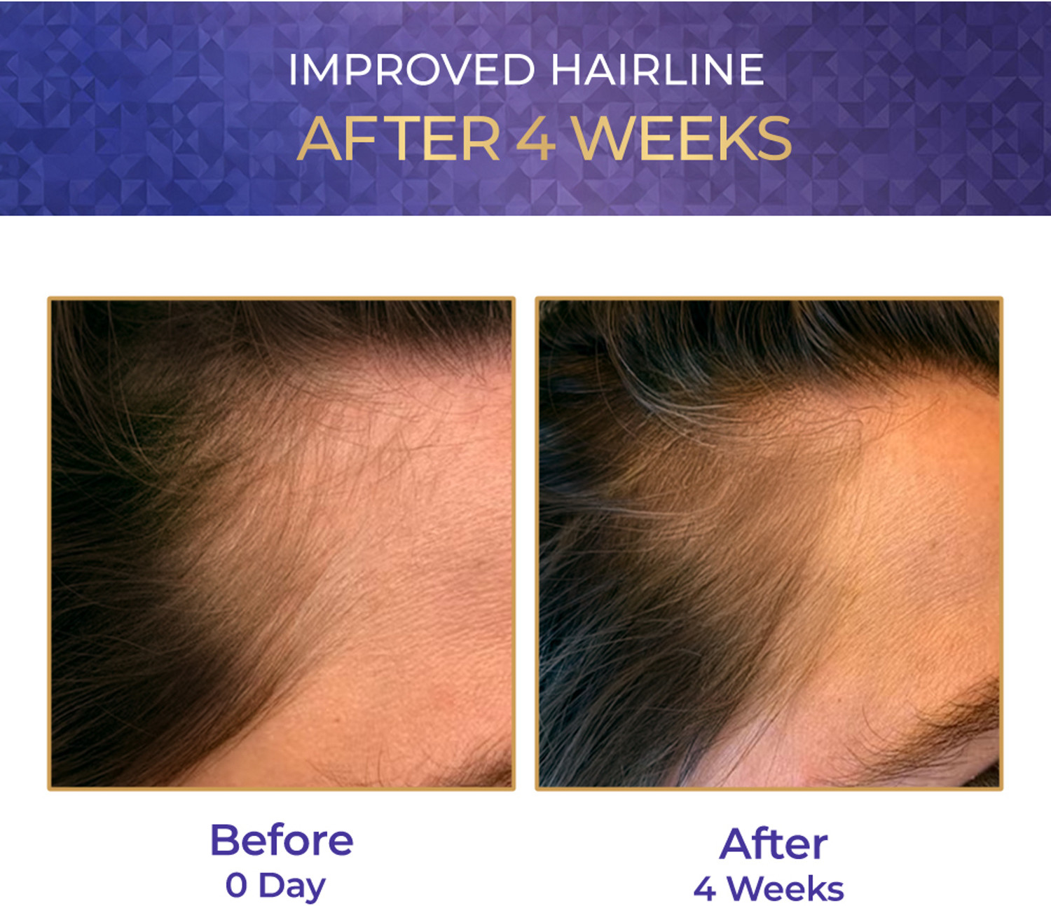 Image of Streax Hair Growth Serum - 30ml, 3% Redensyl, 3% Anagain, 3% Baicapil