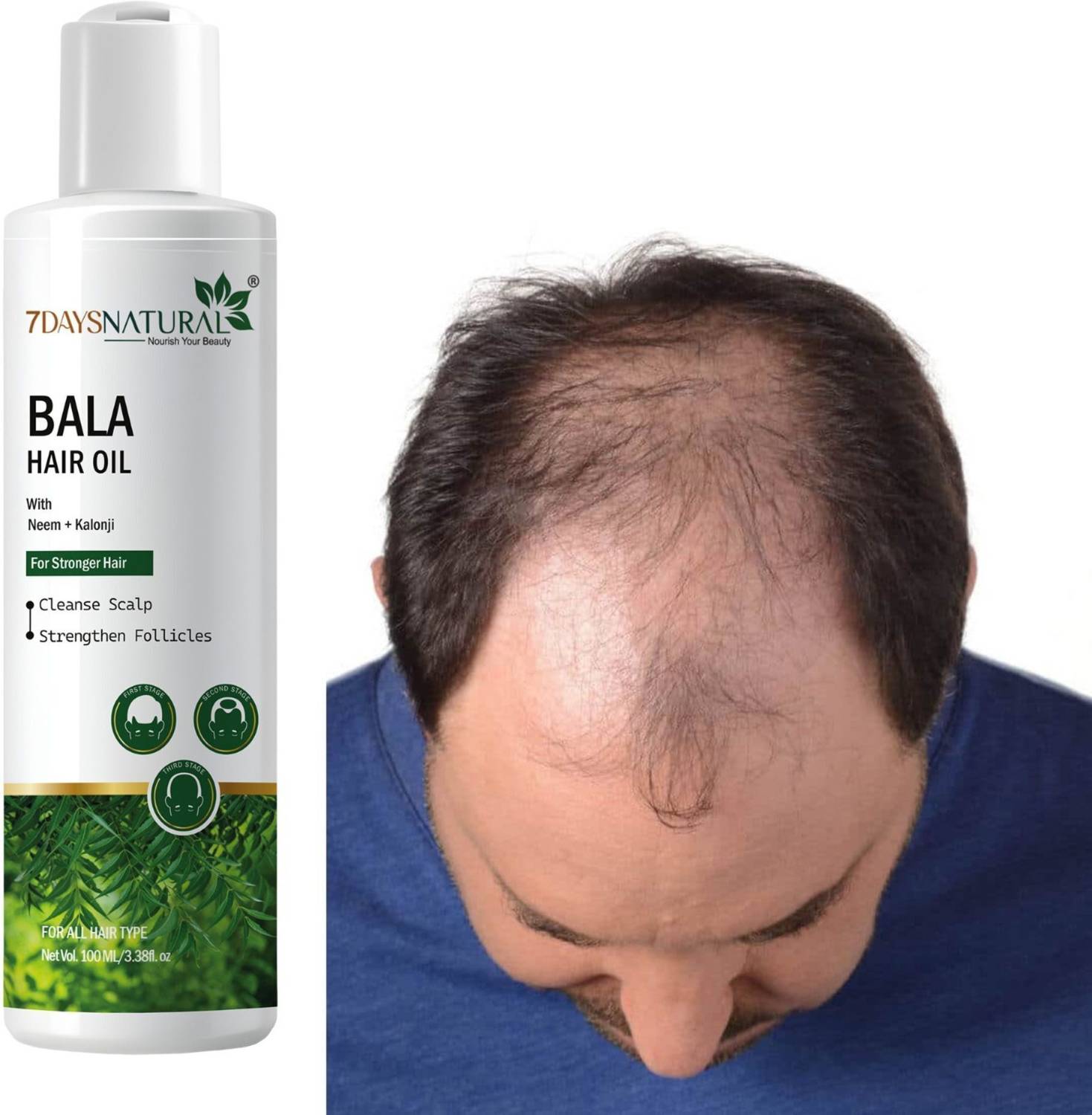 7 Days Bala Hair Growth Serum 3% Redensyl, Kapexil, Procapil, Biotin,Boosts Hair Growth