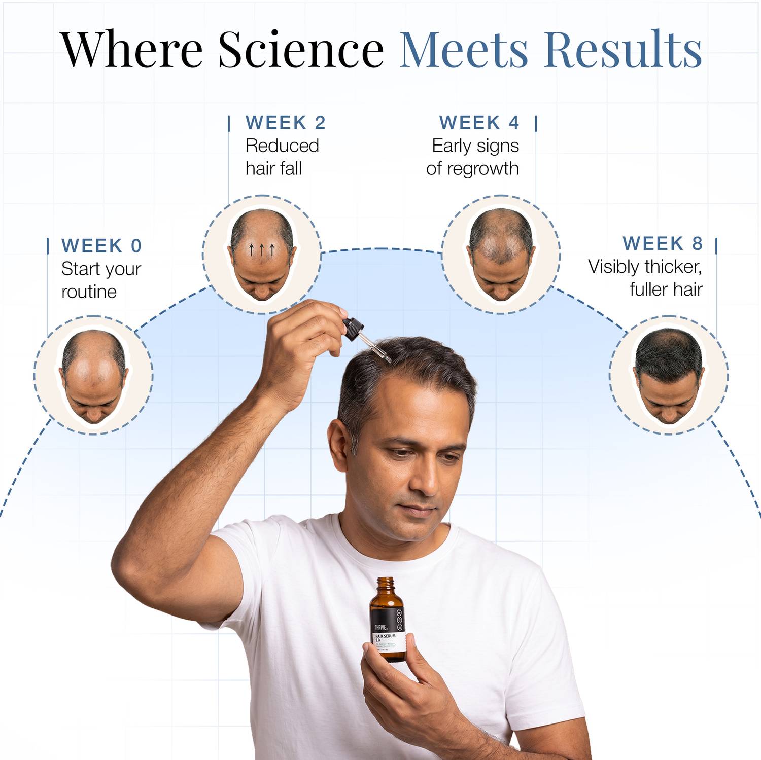ThriveCo Advanced Hair Growth Serum 2.0 30ml - Image 5