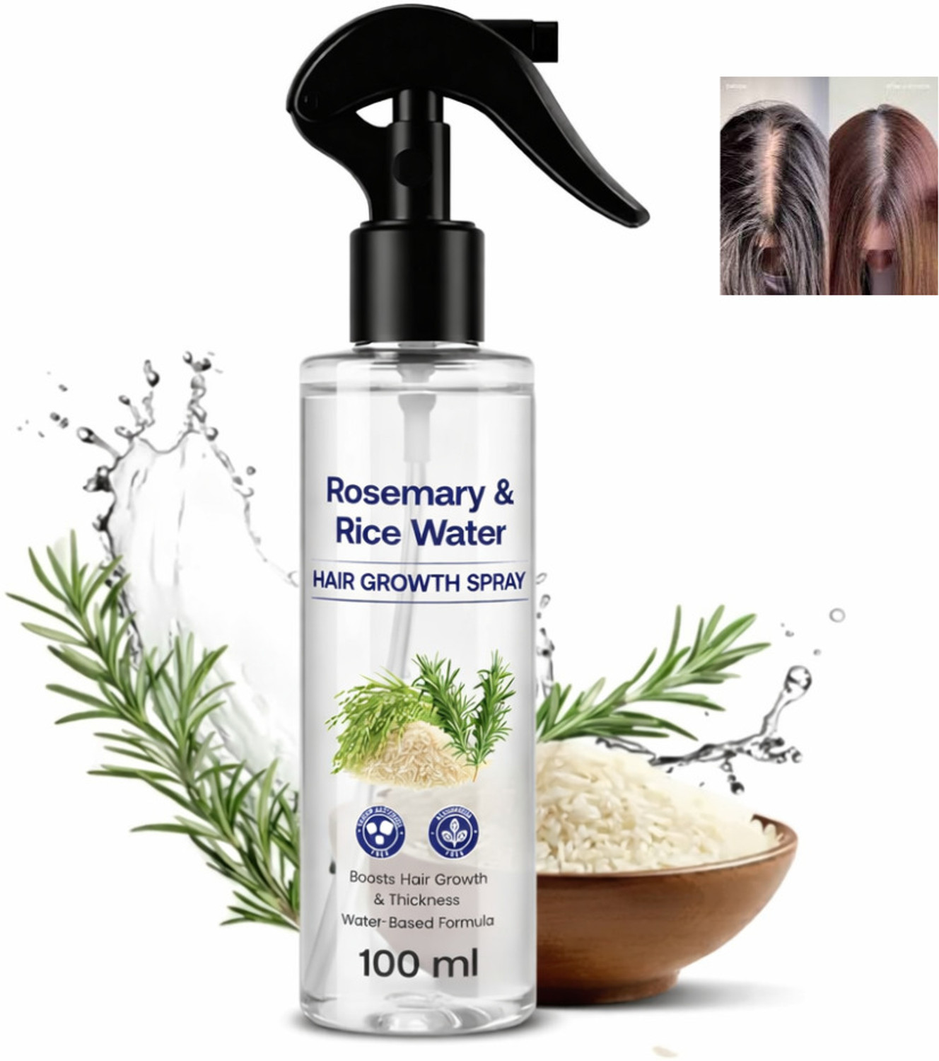 Image of YeoJi ROS Rice Water Hair Growth Spray for Strong Roots & Hair Care Hair Spray