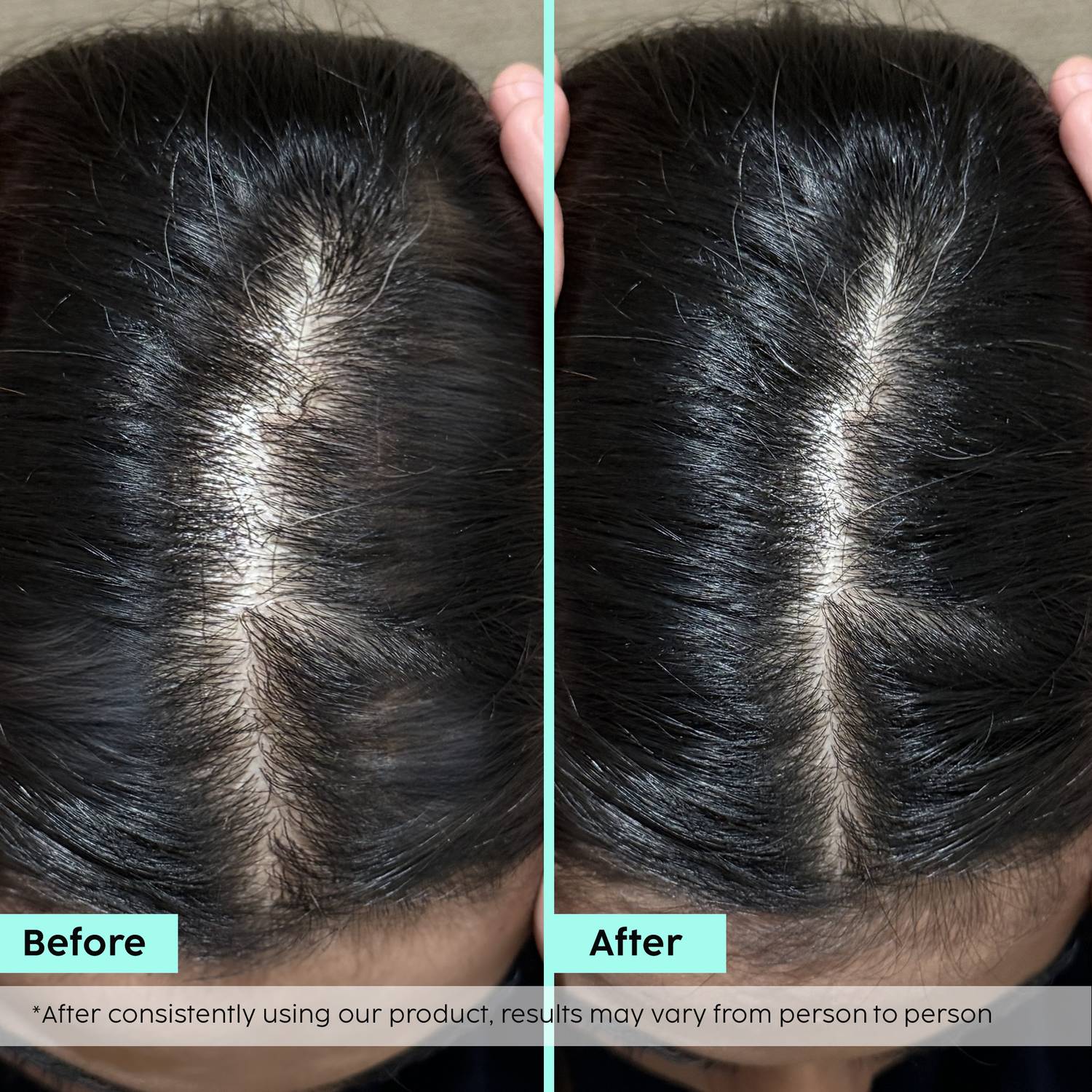 The Plant Fix Plix Rosemary Hair Growth Advanced Hair Spray for f... more