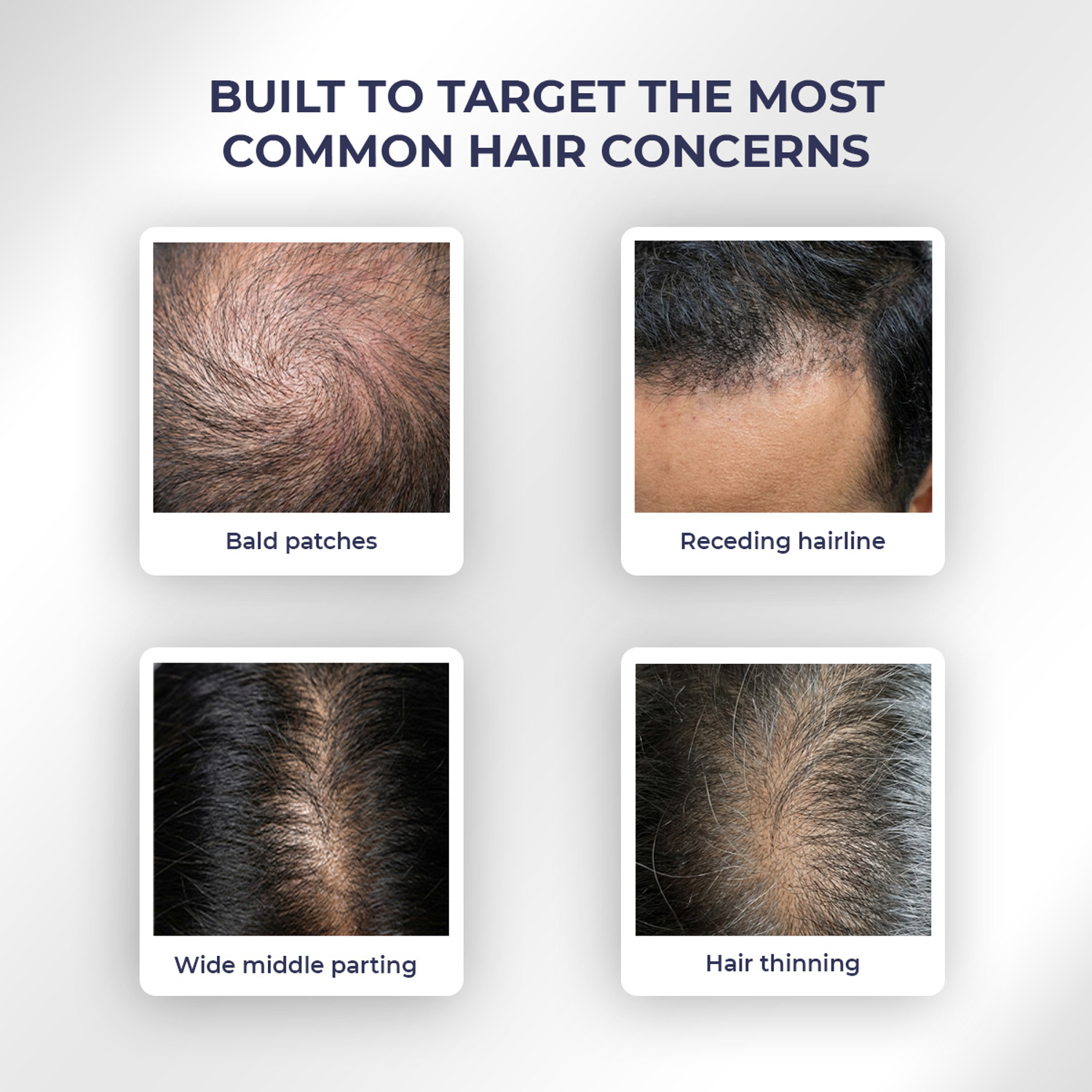 Image of Conscious Chemist Full Strength Anti-Hairfall Rosemary Spray | With Rosemary & Yeast Extract Hair Spray