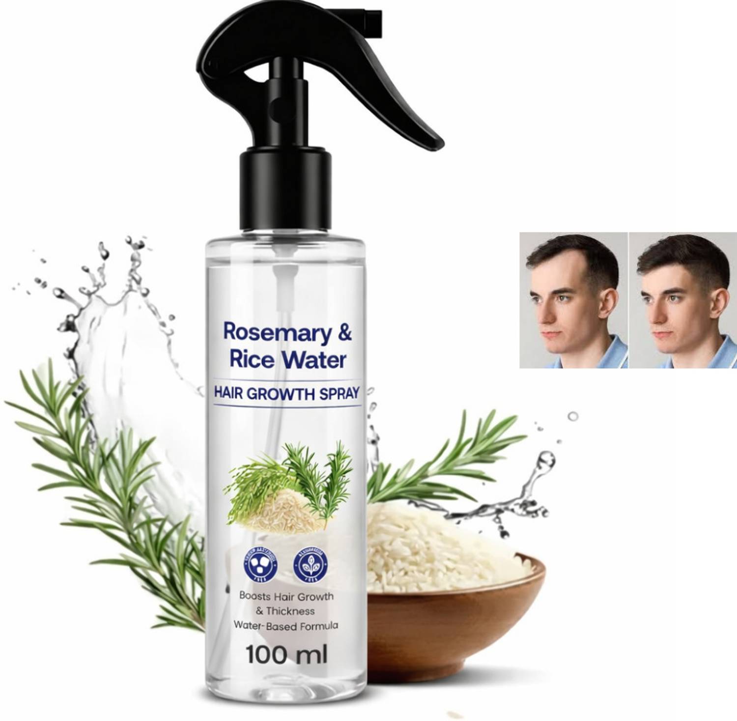 Glow Fox Rosemary Hair Growth Spray - Image 1