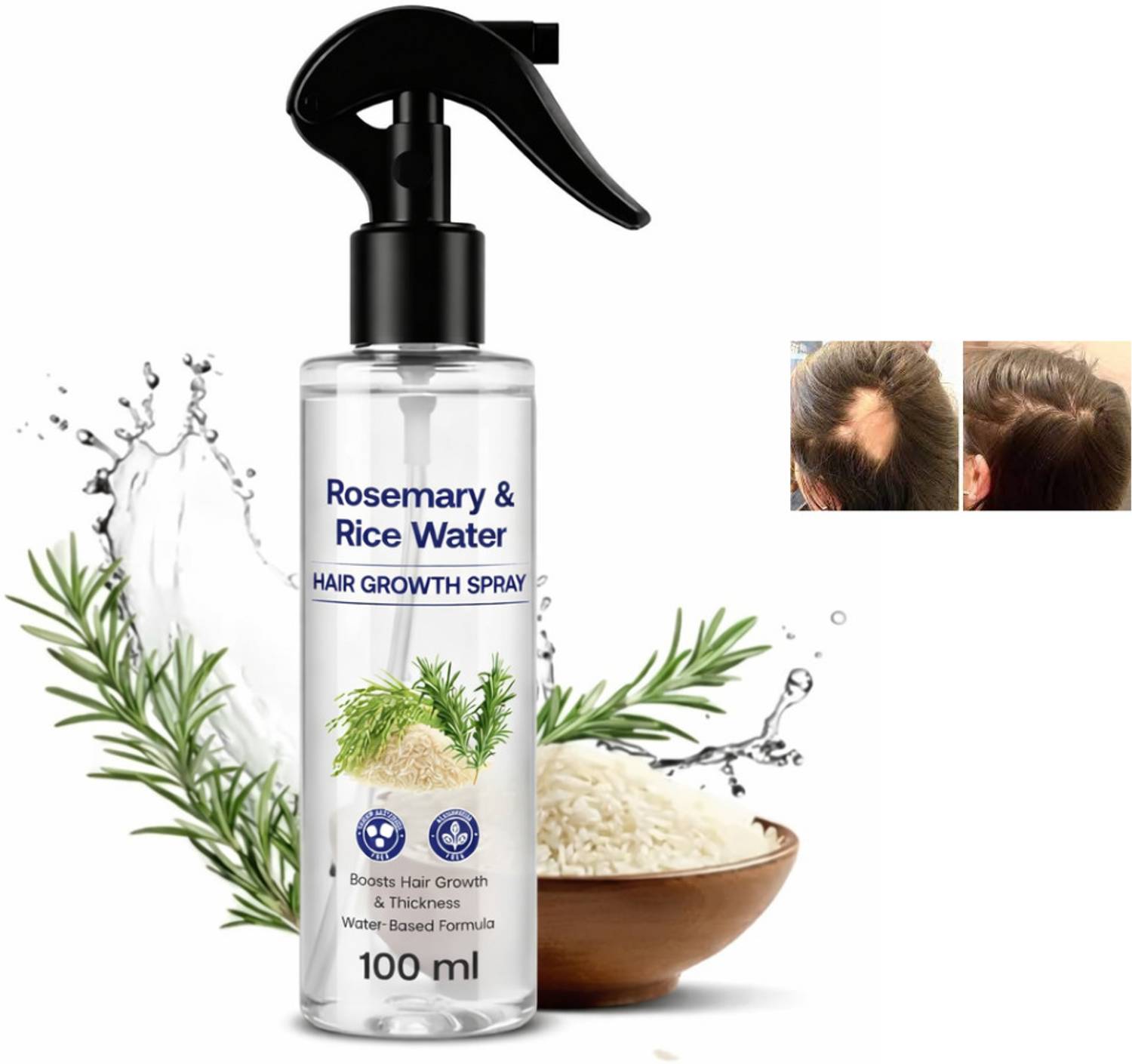 BRALCON Rosemary Hair Growth Spray - Image 1