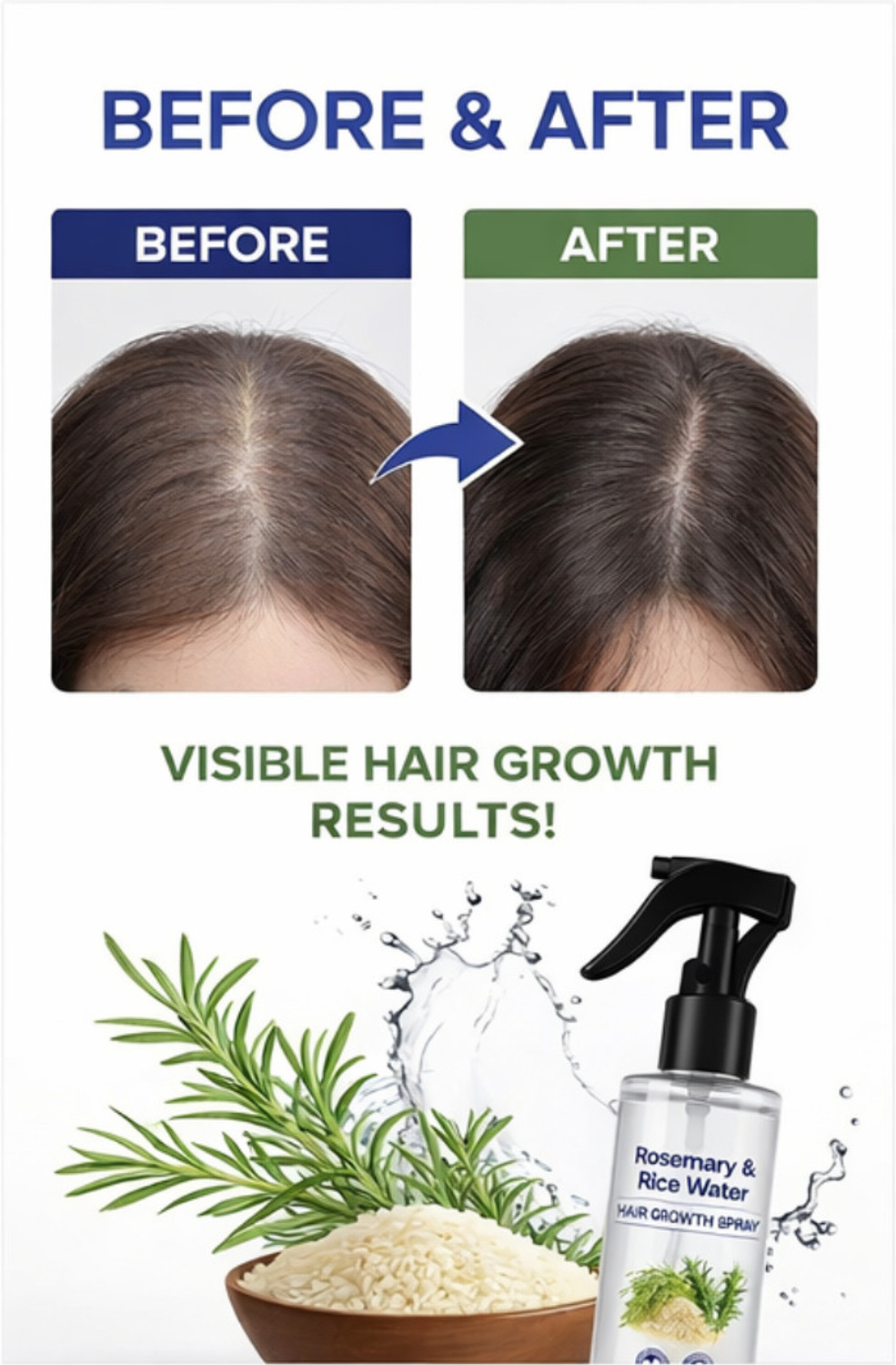 Image of LEANAND Plant Fix Rosemary Hair Growth Advanced Hair Spray Hair Repair Care Hair Spray.F Hair Spray