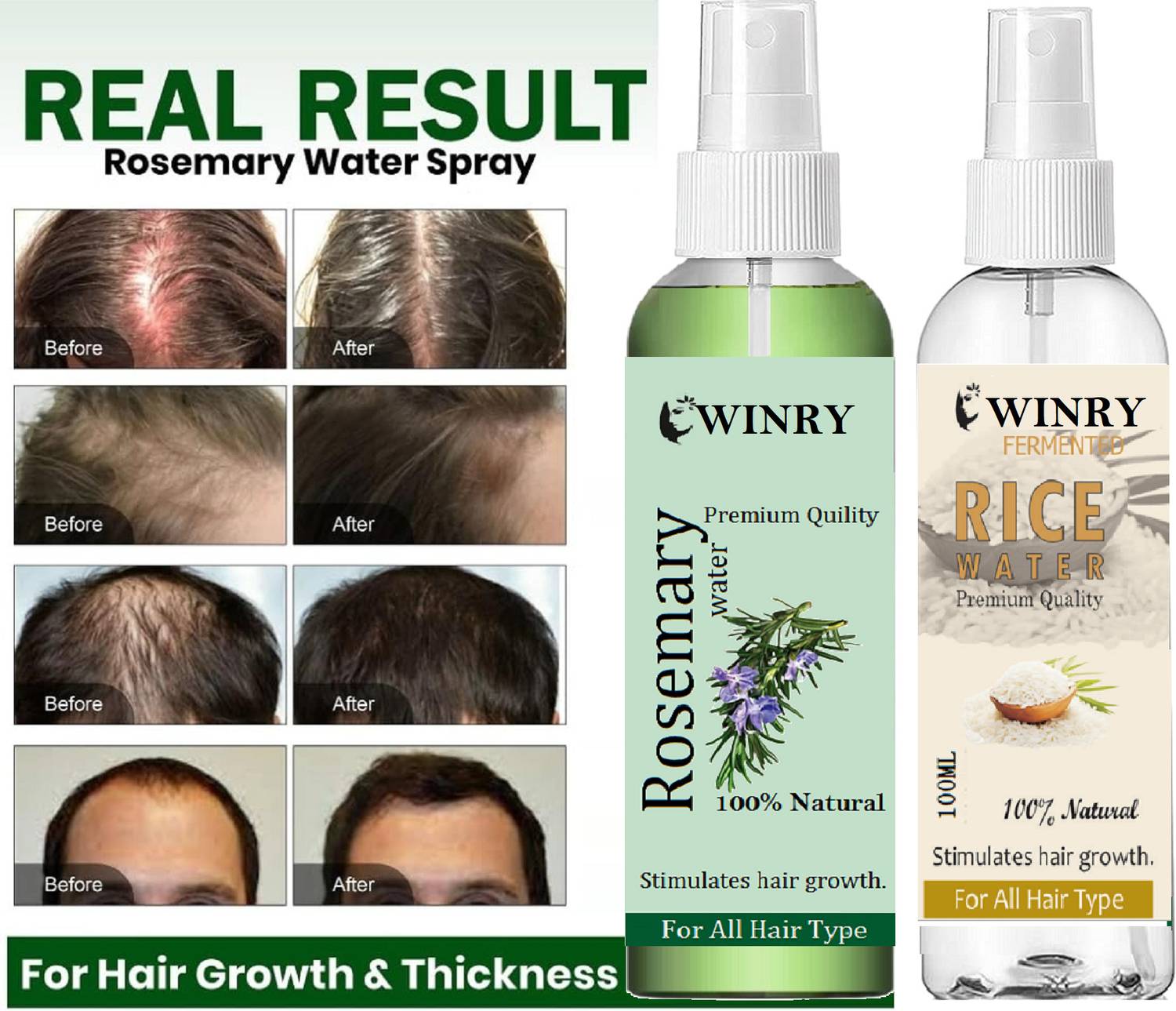 winry Rosemary Rice Water Spray for Hair Growth Strengthen