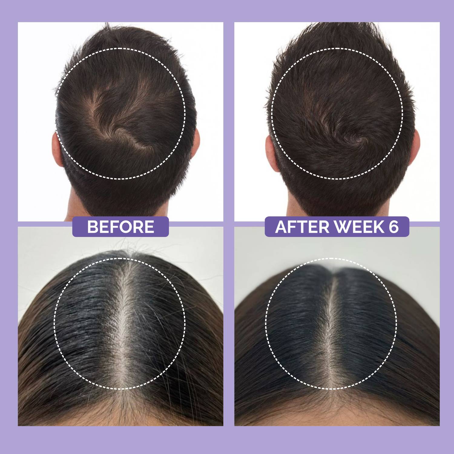 Phillox Advanced Hair Growth Spray 3% Redensyl - Image 4