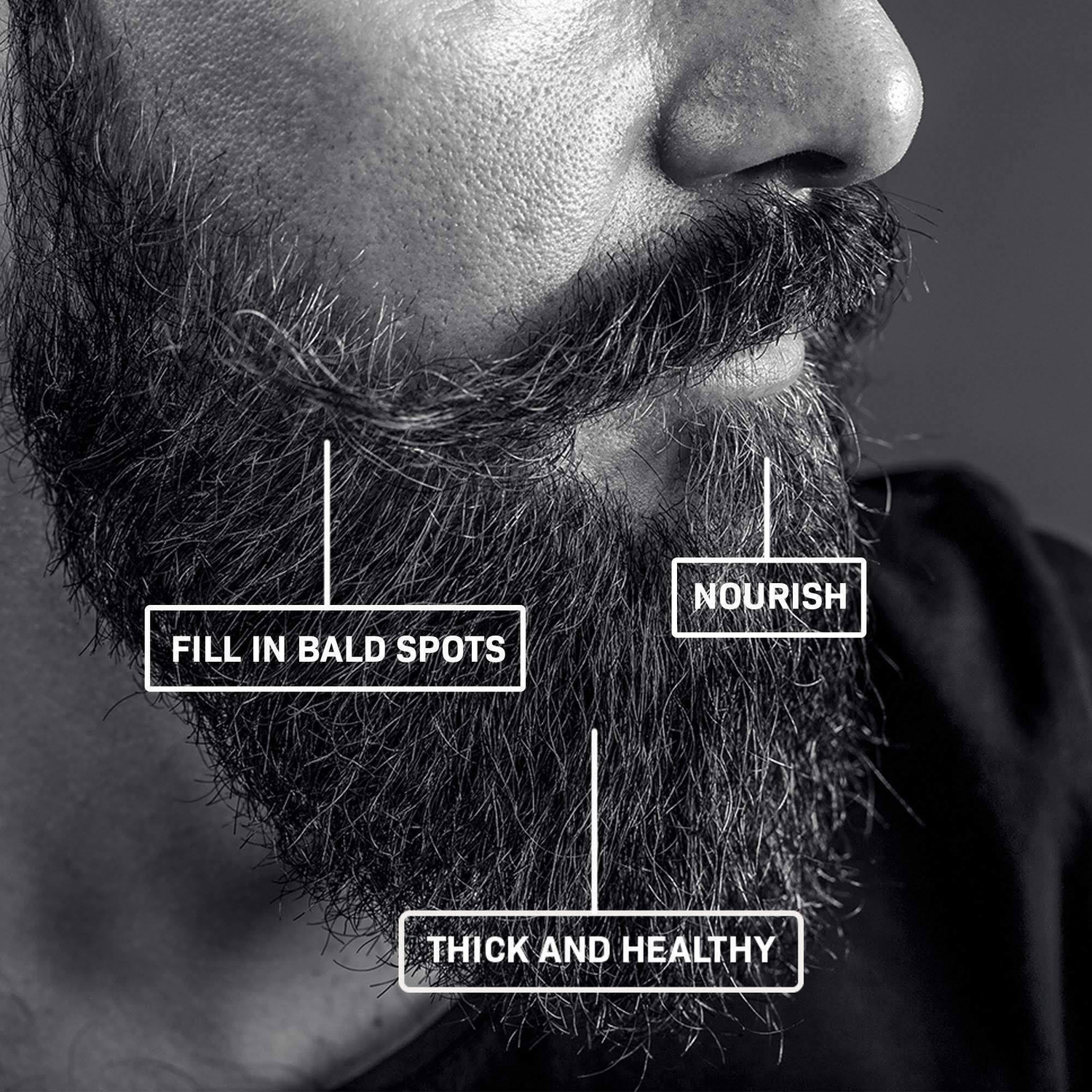 Image of VILFLY Mind Matters Beard Growth Roller Derma Roller 1.00mm Hair Growth Stimulator