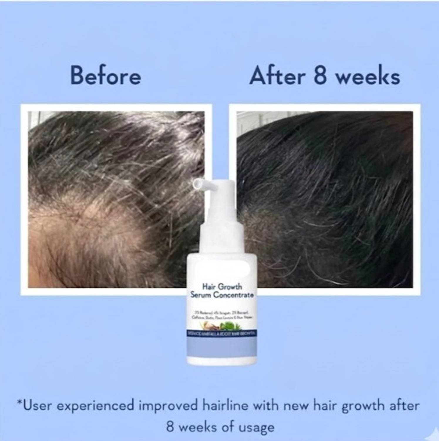 AKANSHA Hair Growth Serum Concentrate - Image 3