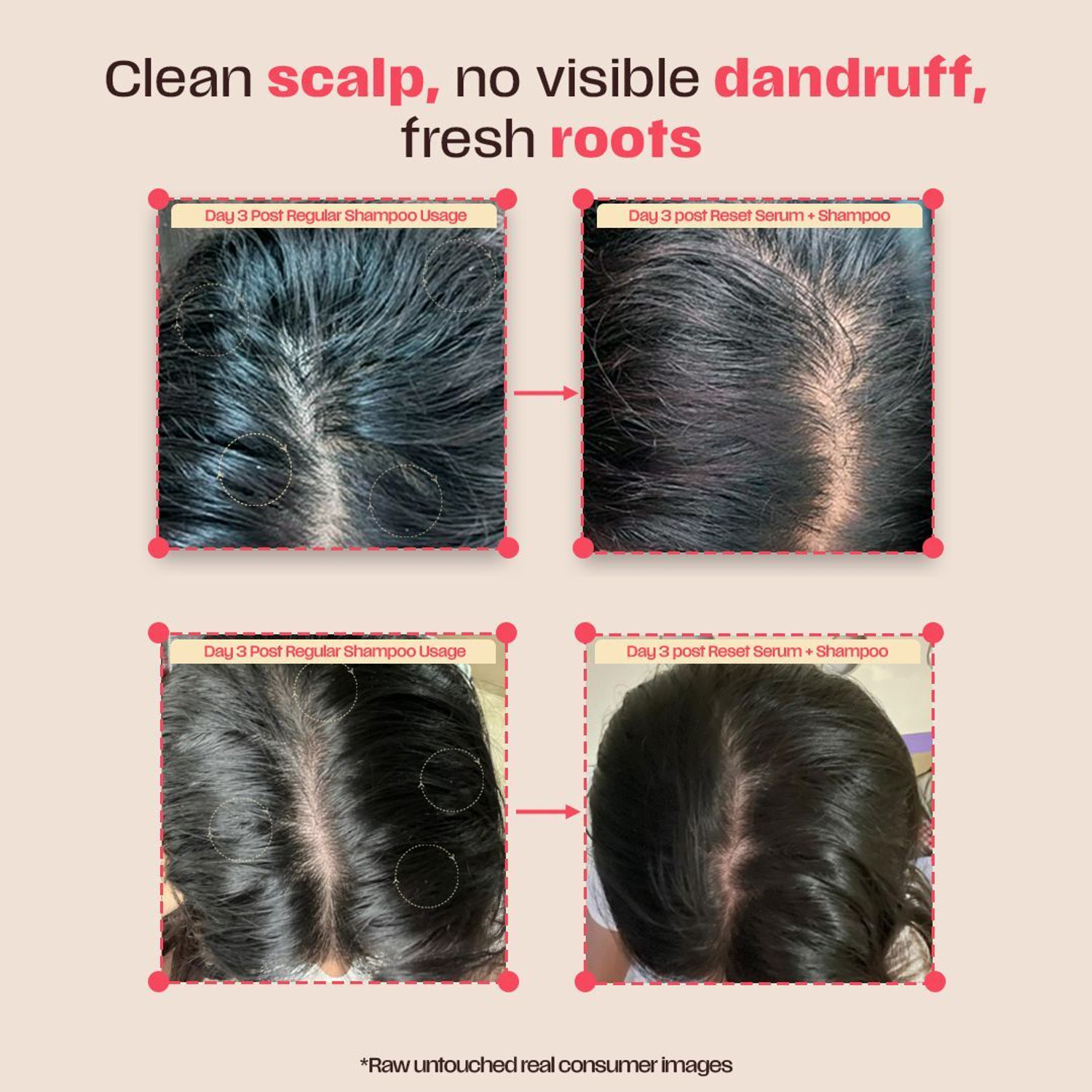 Image of Days Ahead Pre-Wash Reset Serum For Oily Scalp Salicylic Acid, Glycolic Acid, Ceramide (100 ml)