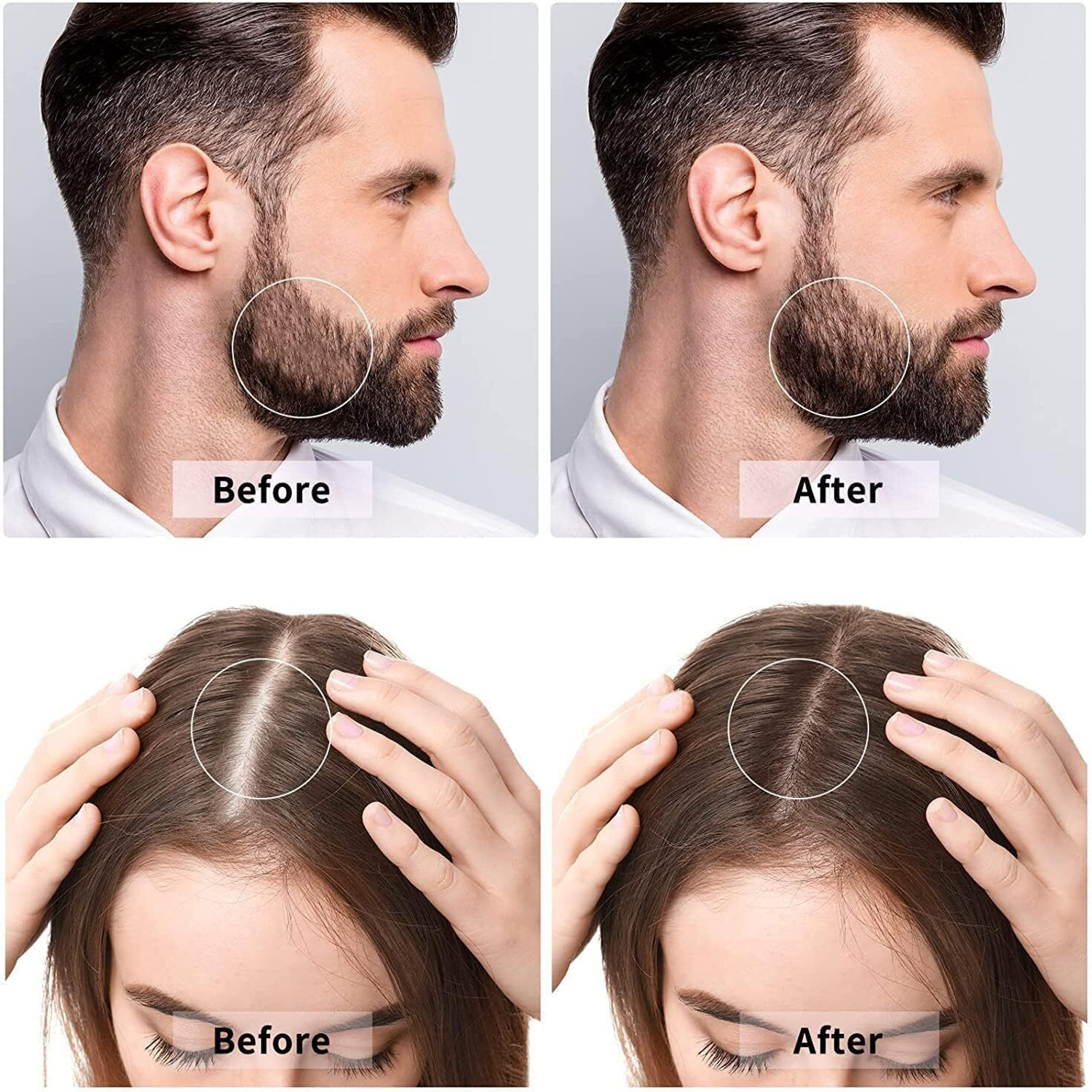 Image of DIDMENT Derma 3 in 1 Skin care and Hair Care Combo for Men and Women