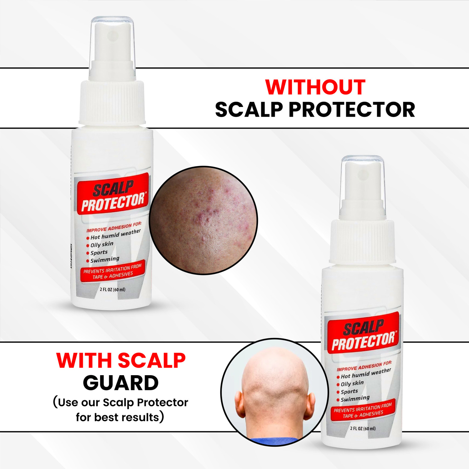Image of Scalp Protector Spray for Hair Patch & Wigs| Prevents Irritation from Adhesives-60ml